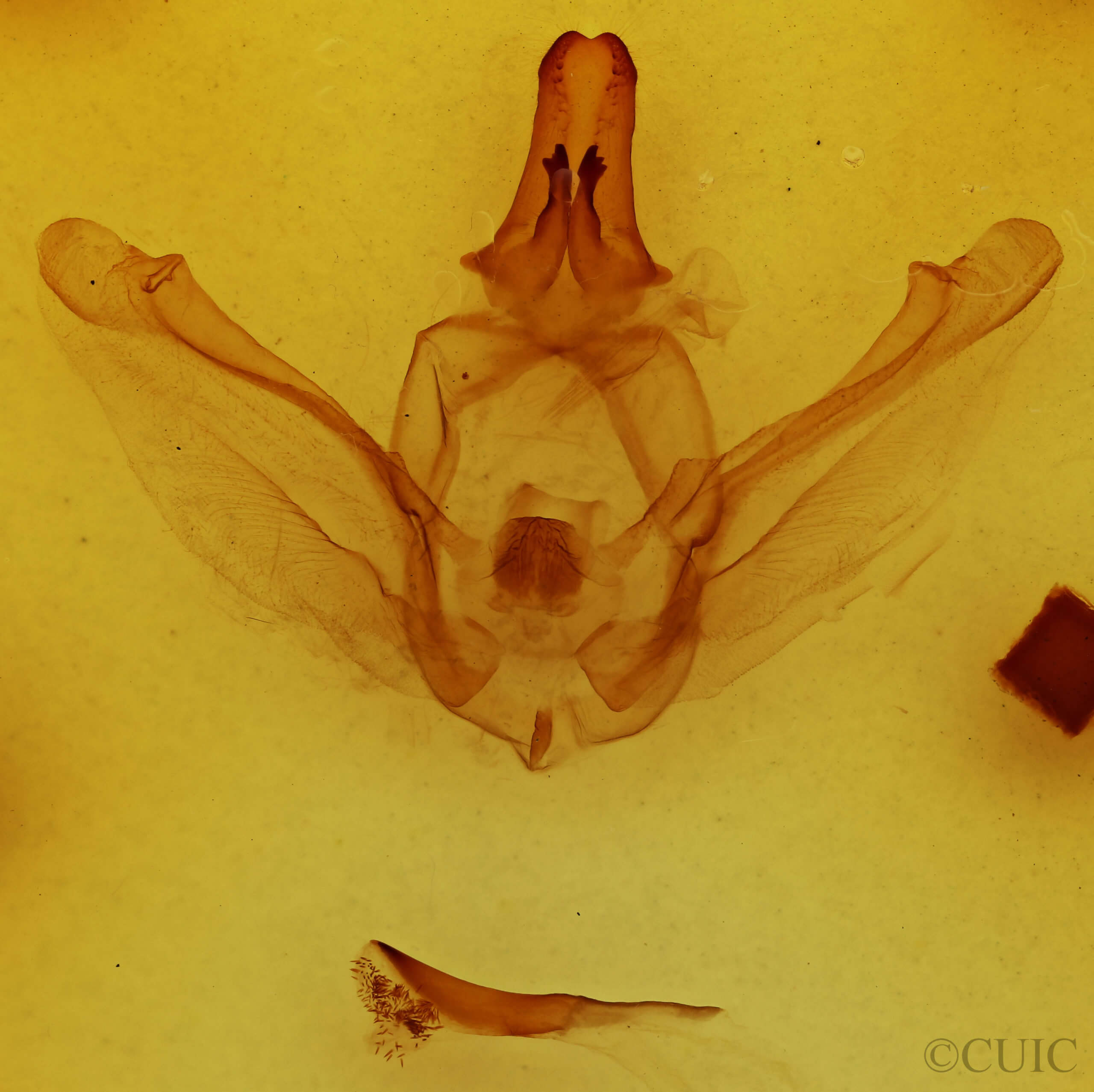 genitalia view of adult Lobeza