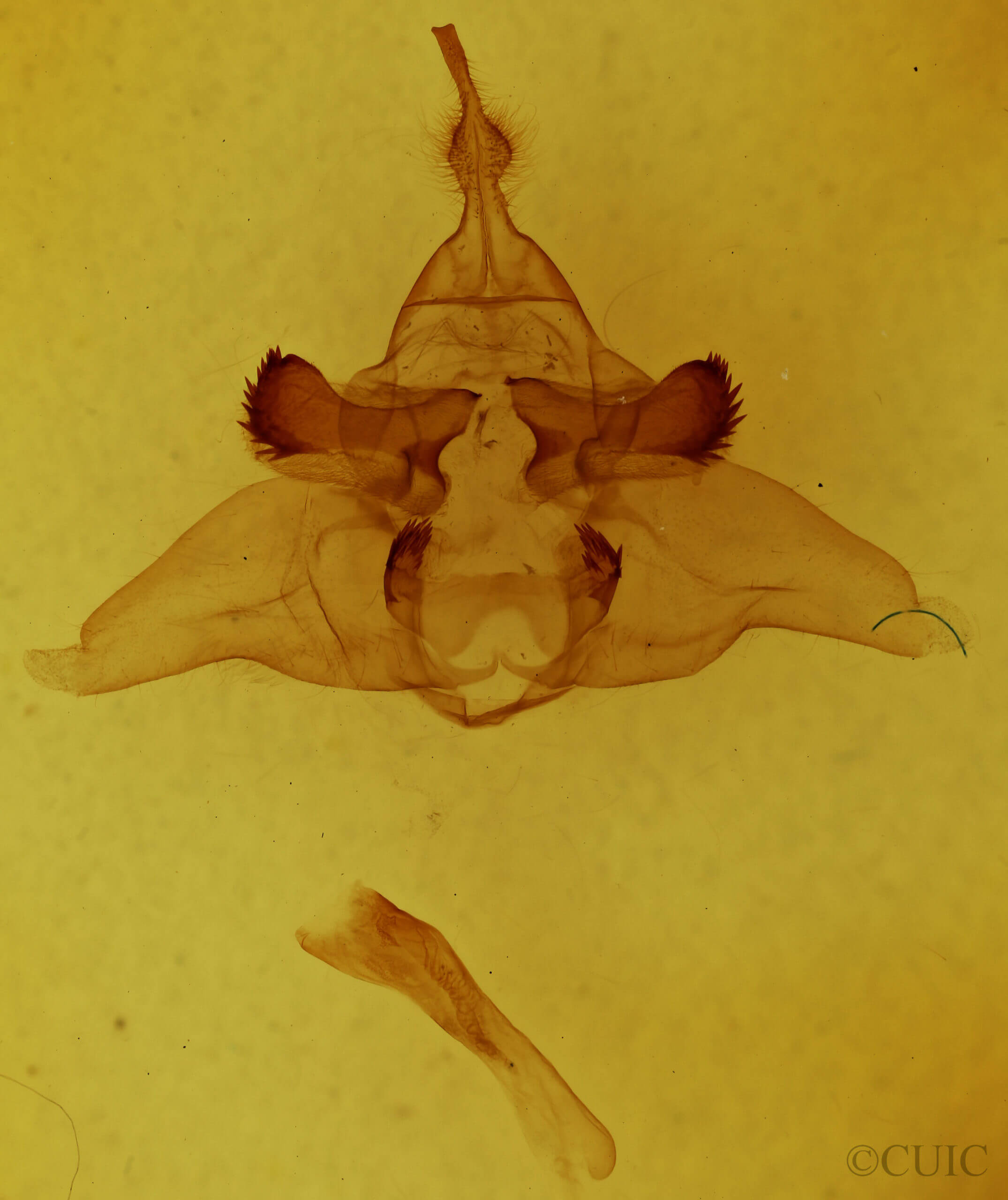 genitalia view of adult Lophocampa maculata