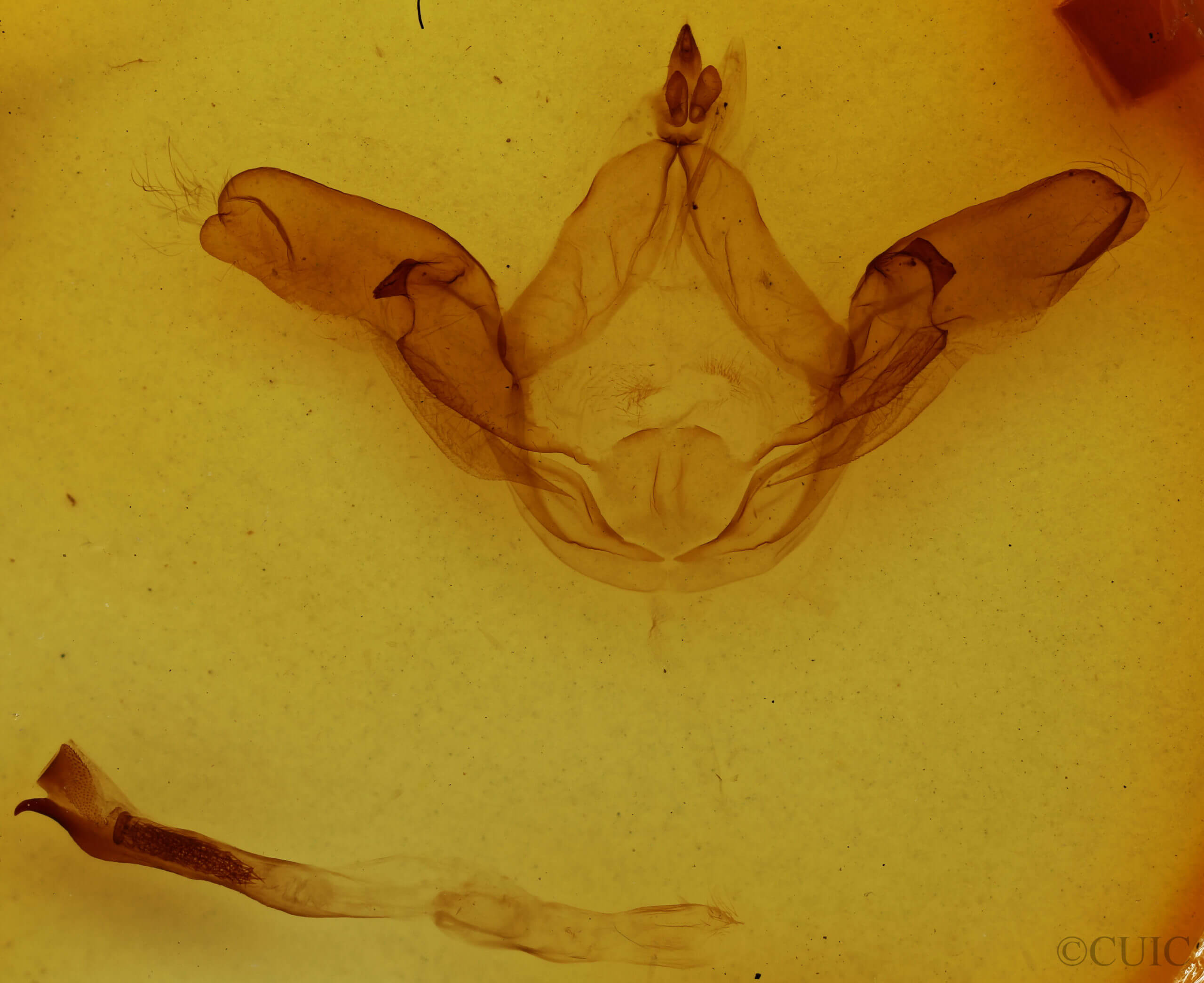 genitalia view of adult Lophocosma atriplaga