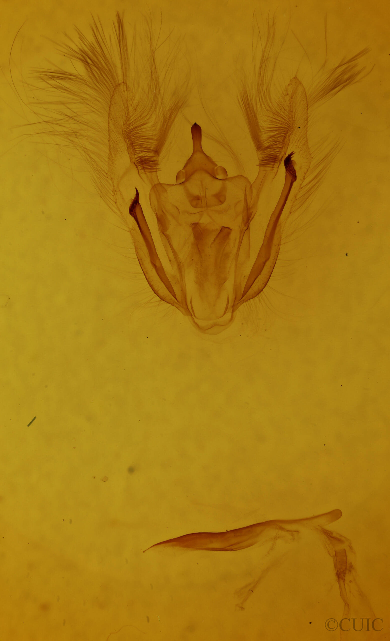 genitalia view of adult Melanolophia canadaria