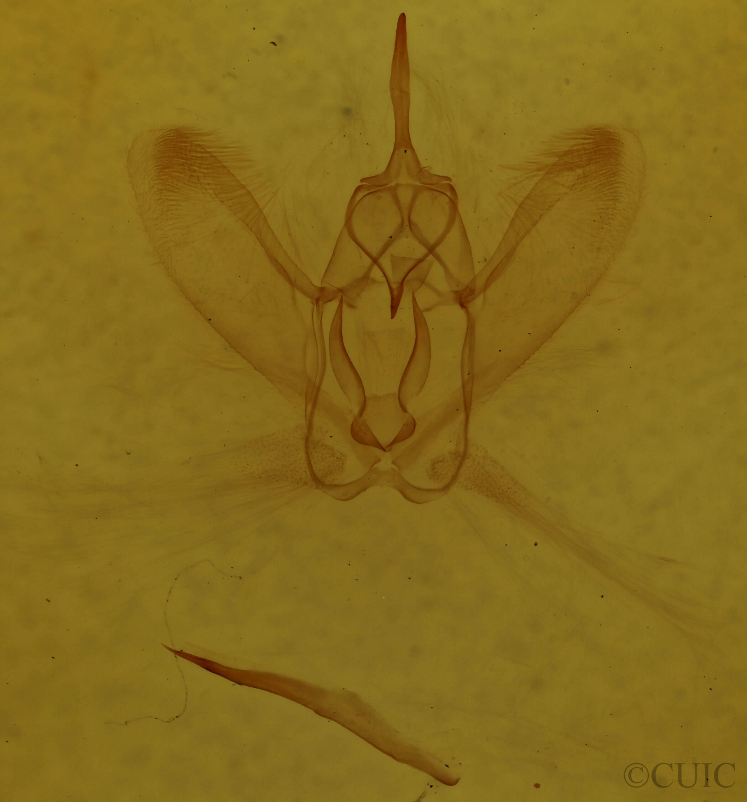 genitalia view of adult Metarranthis amyrisaria