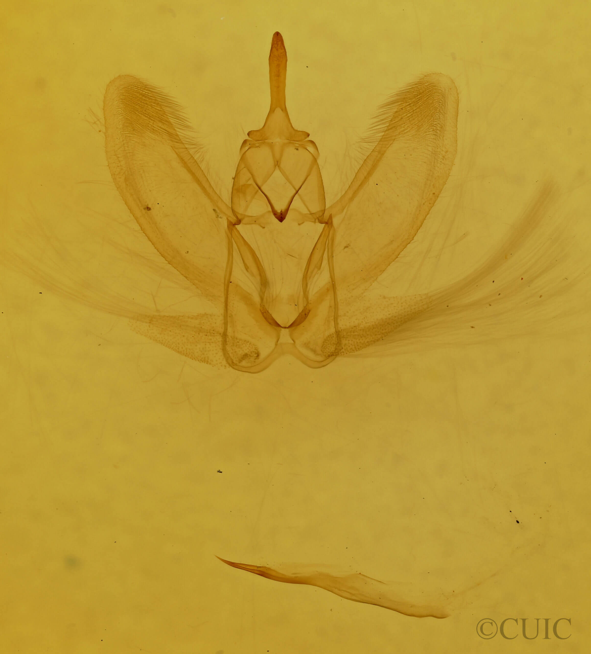 genitalia view of adult Metarranthis homuraria