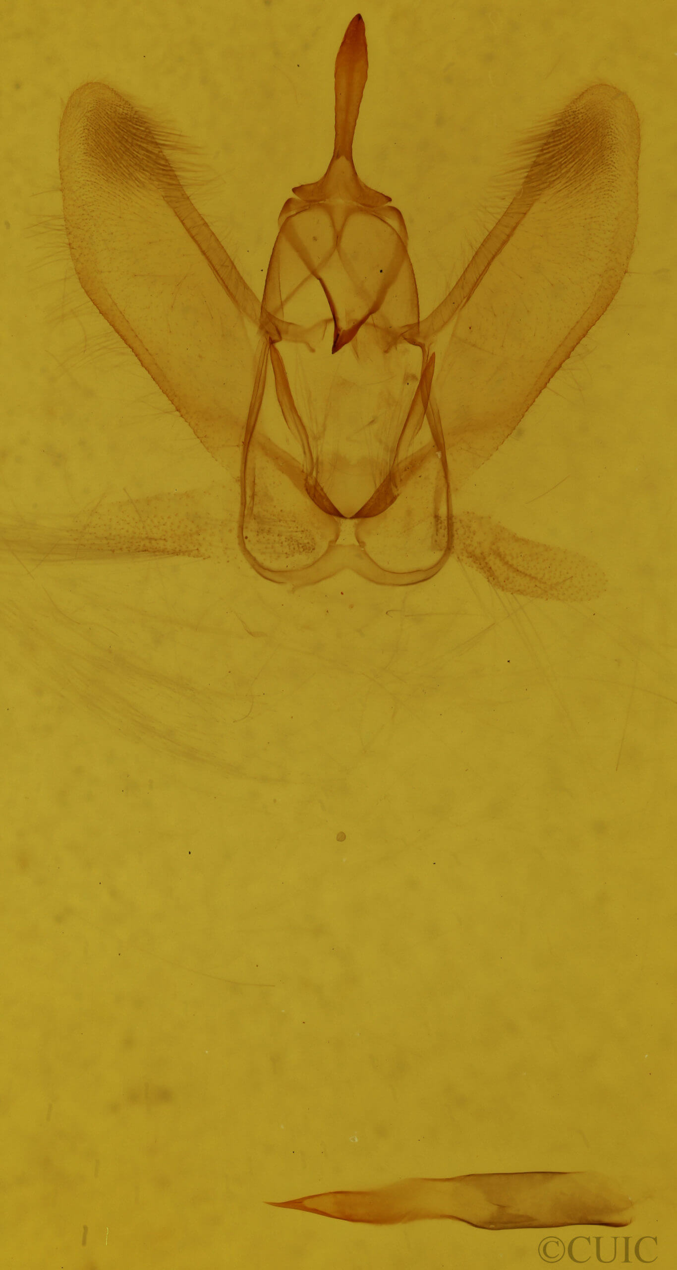 genitalia view of adult Metarranthis  homuraria