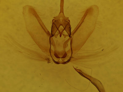 genitalia view of adult Metarranthis obfirmaria