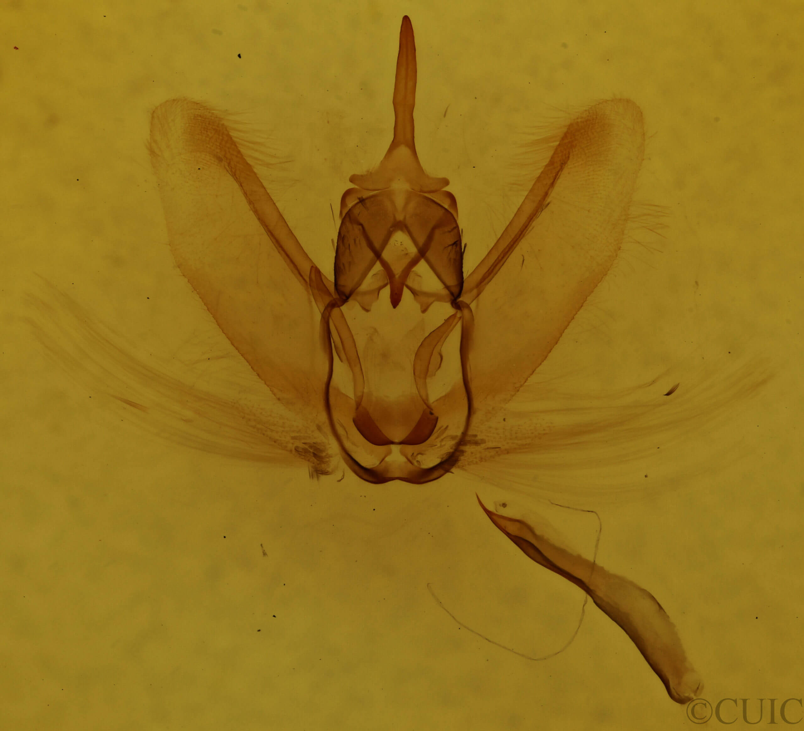 genitalia view of adult Metarranthis obfirmaria