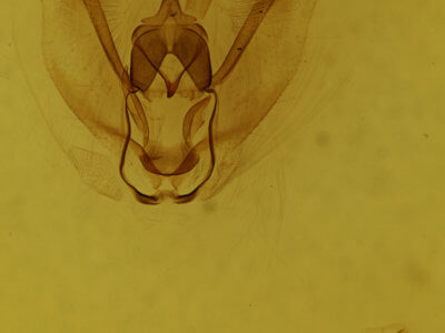 genitalia view of adult Metarranthis obfirmaria