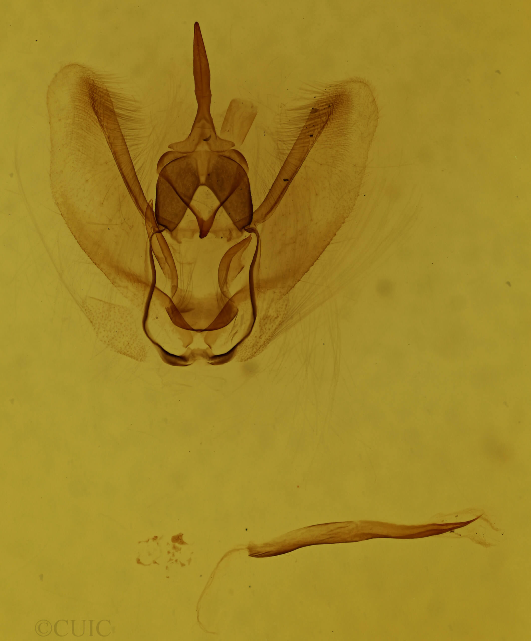 genitalia view of adult Metarranthis obfirmaria