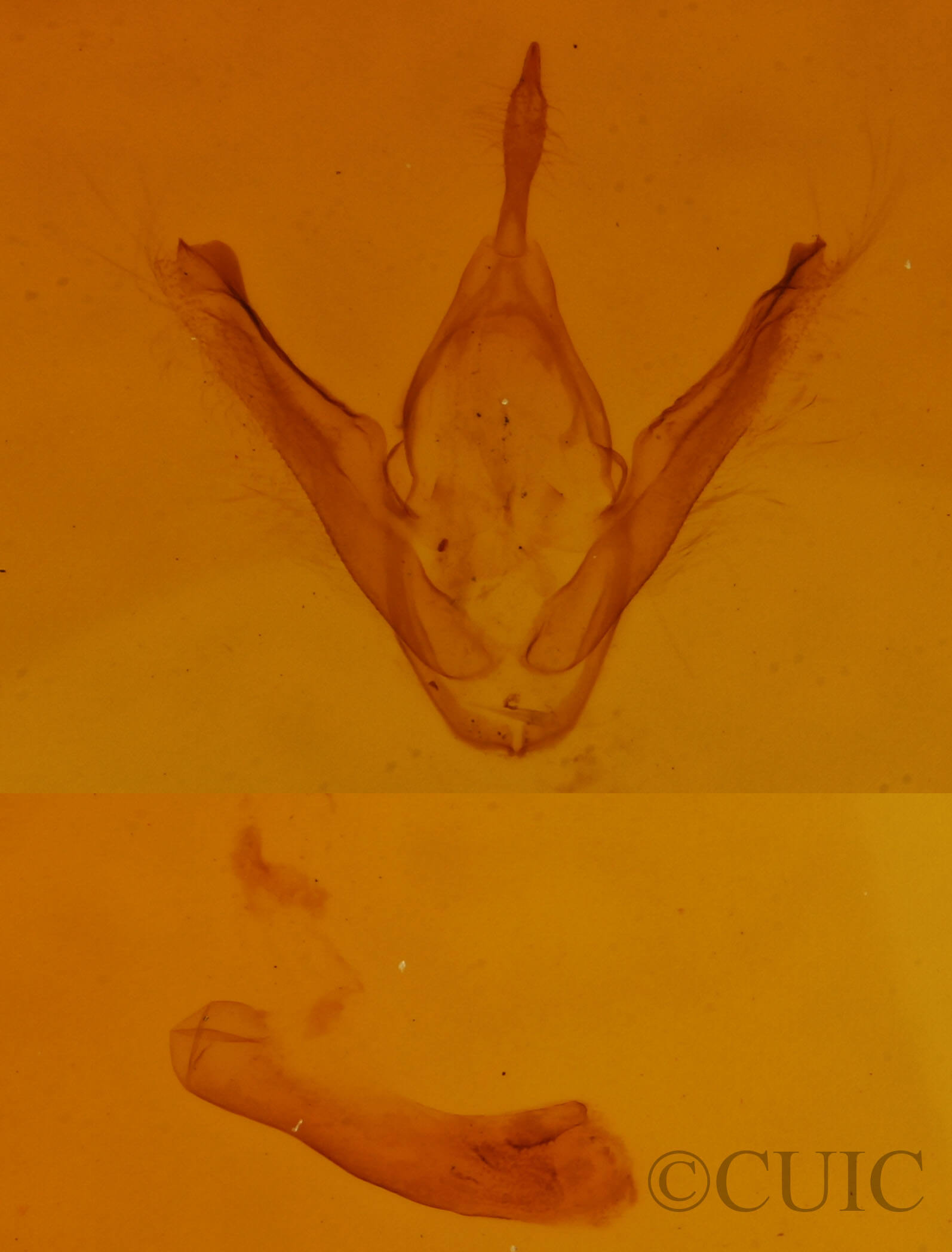 genitalia view of adult Nigetia formosalis