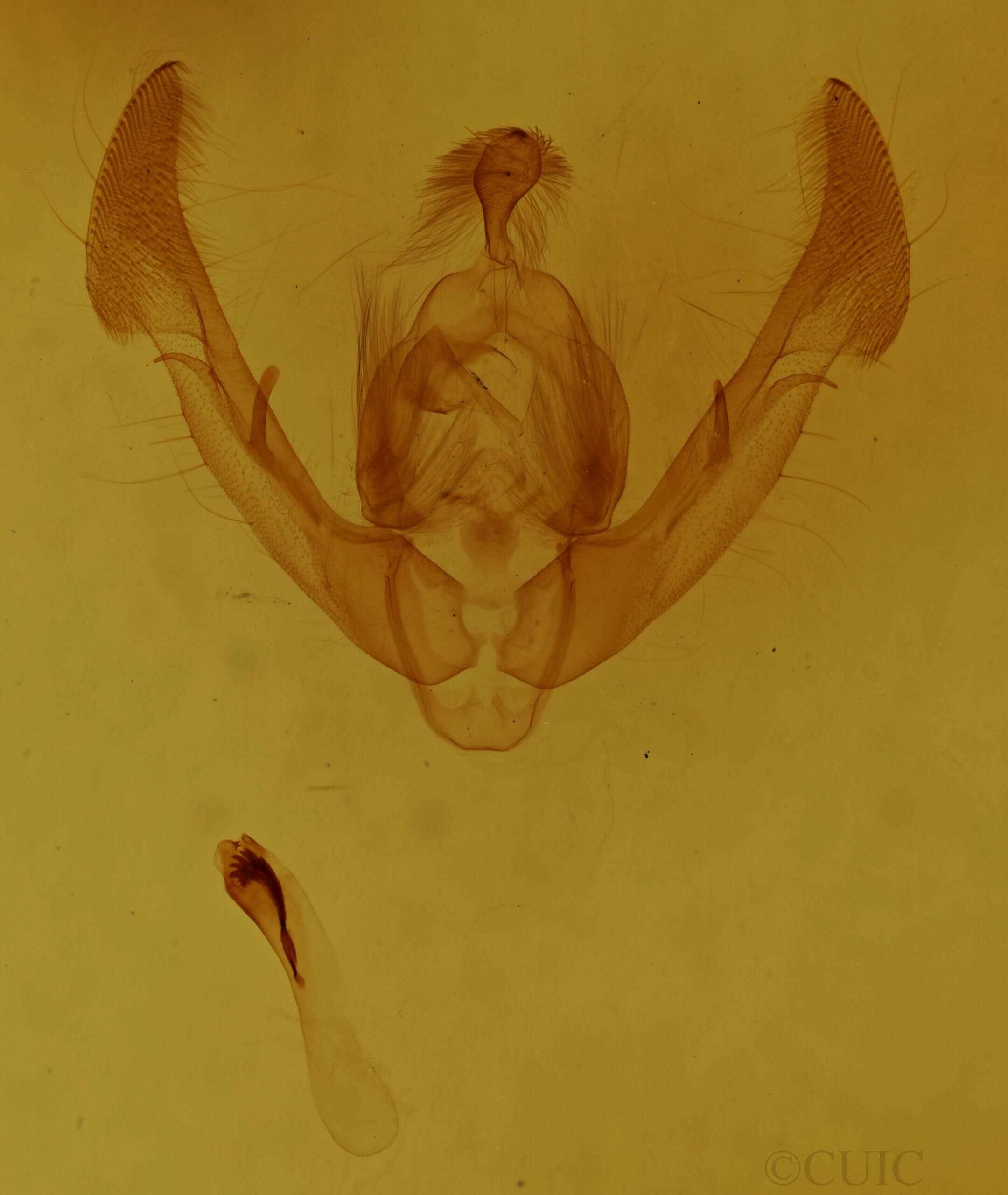 genitalia view of adult Oligia chlorostigma