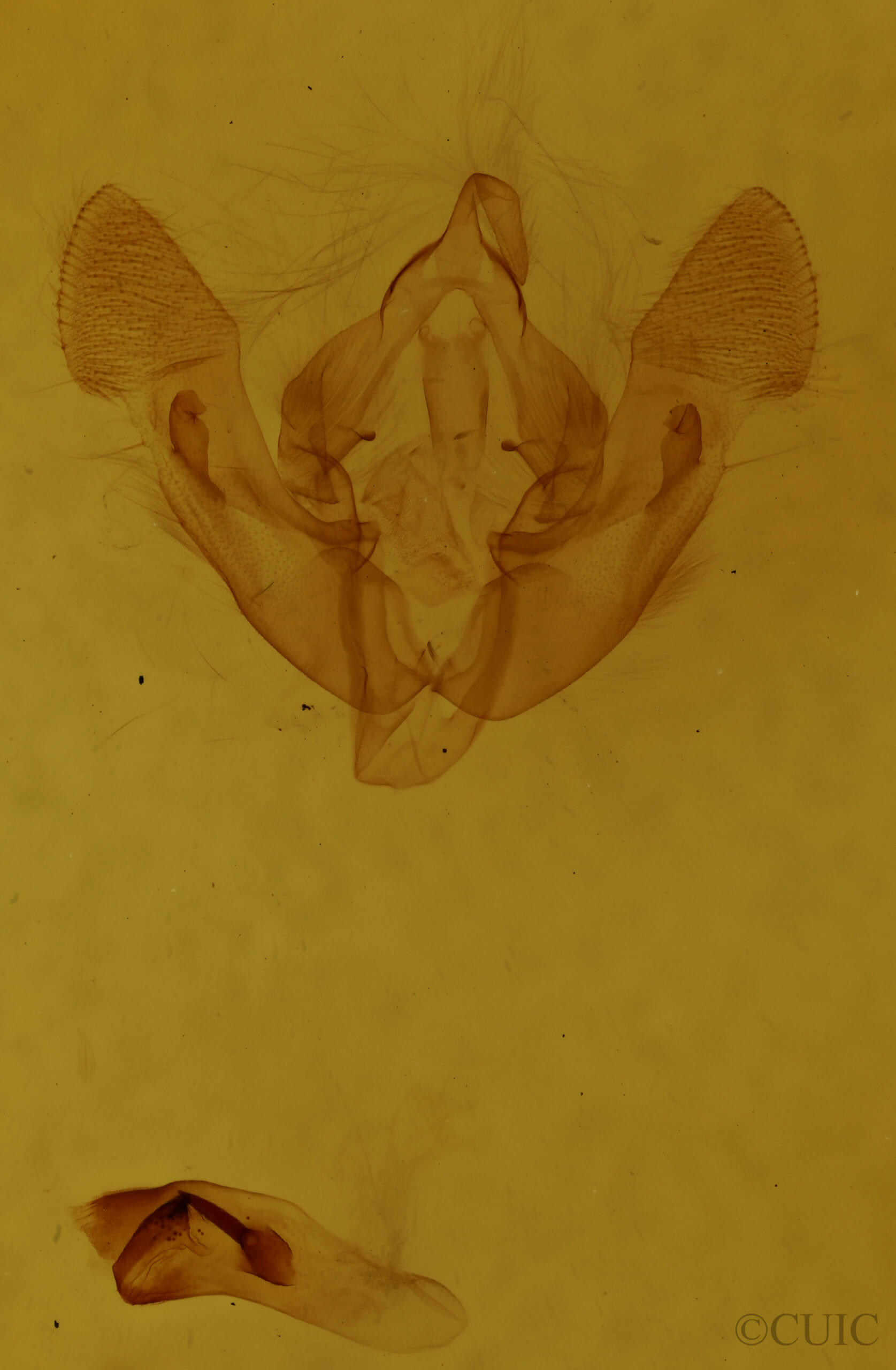 genitalia view of adult Oligia minuscula