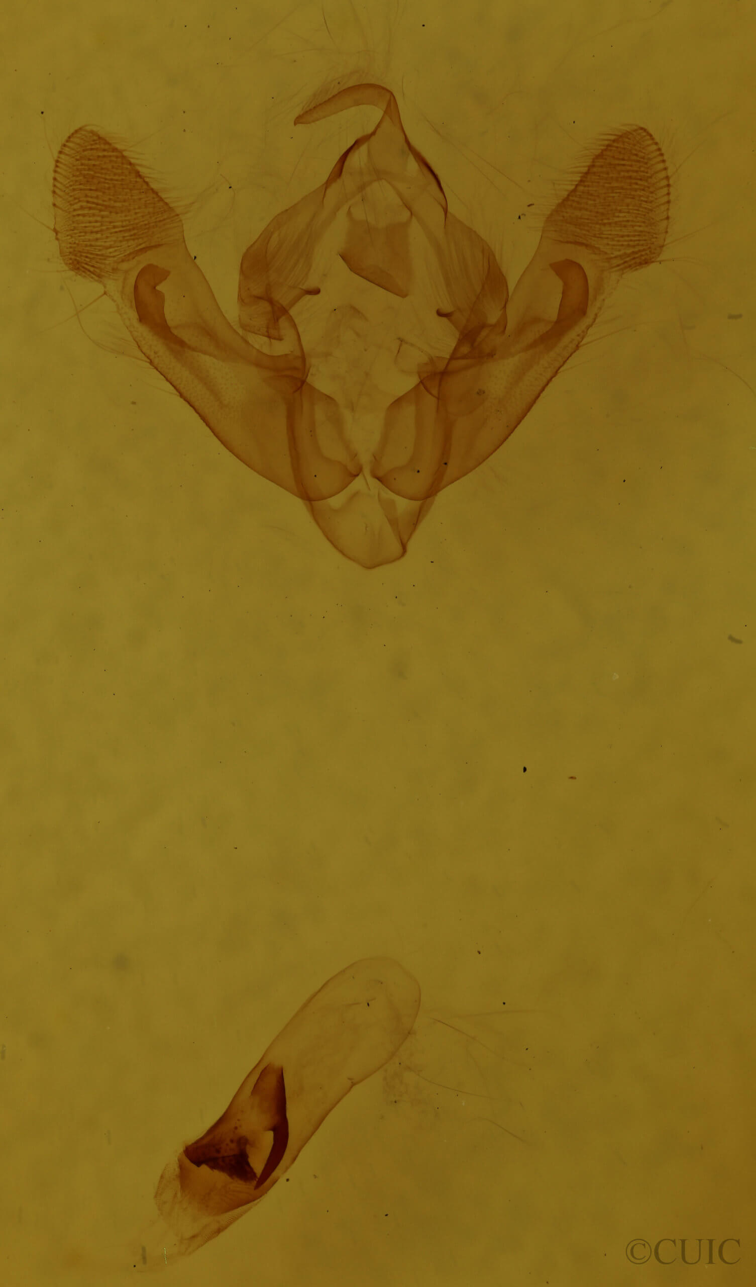 genitalia view of adult Oligia minuscula