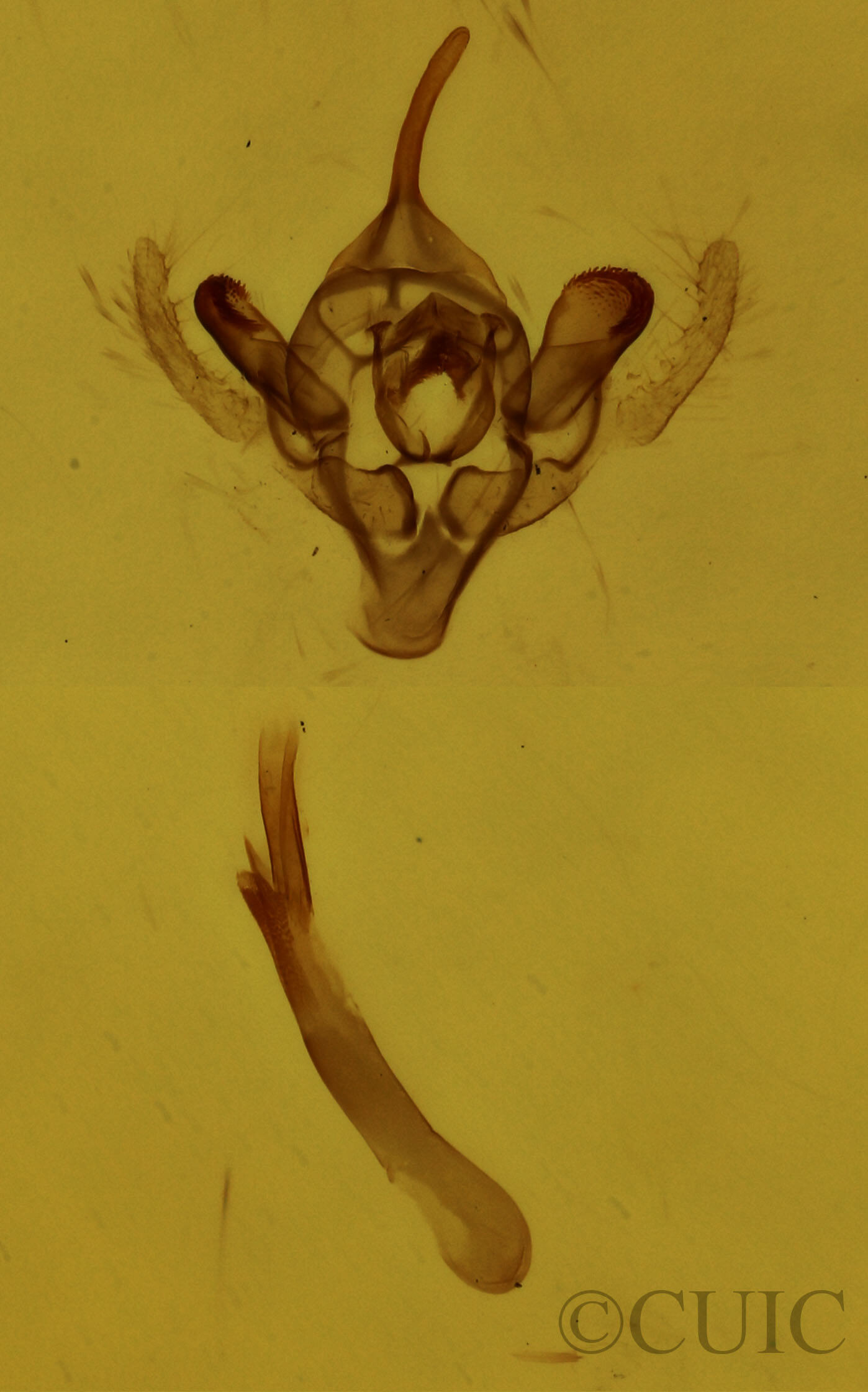 genitalia view of adult Orthonama obstipata