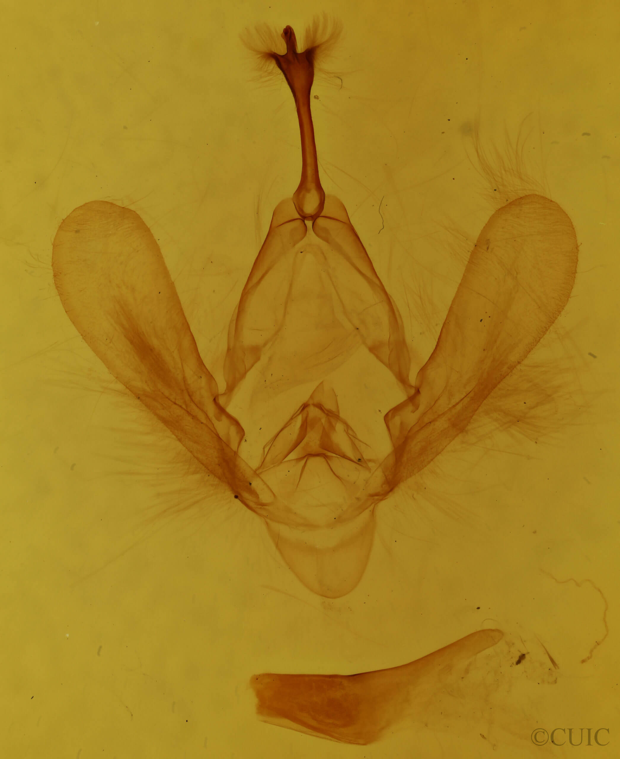 genitalia view of adult Panopoda carneicosta
