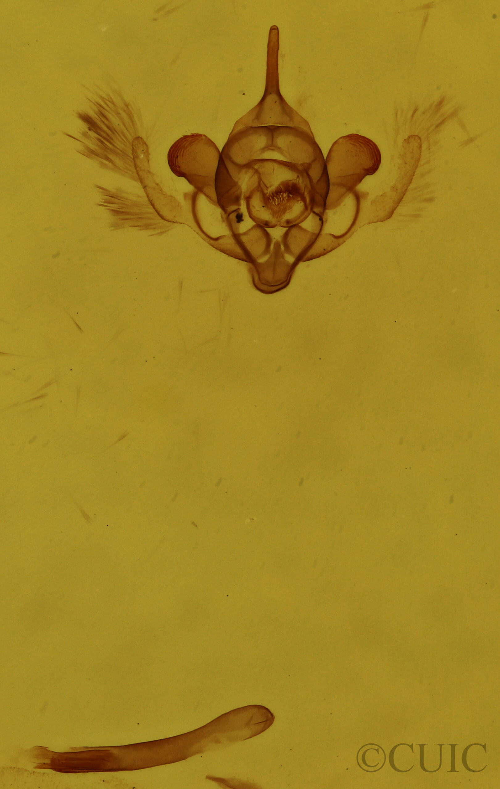 genitalia view of adult Orthonama obstipata