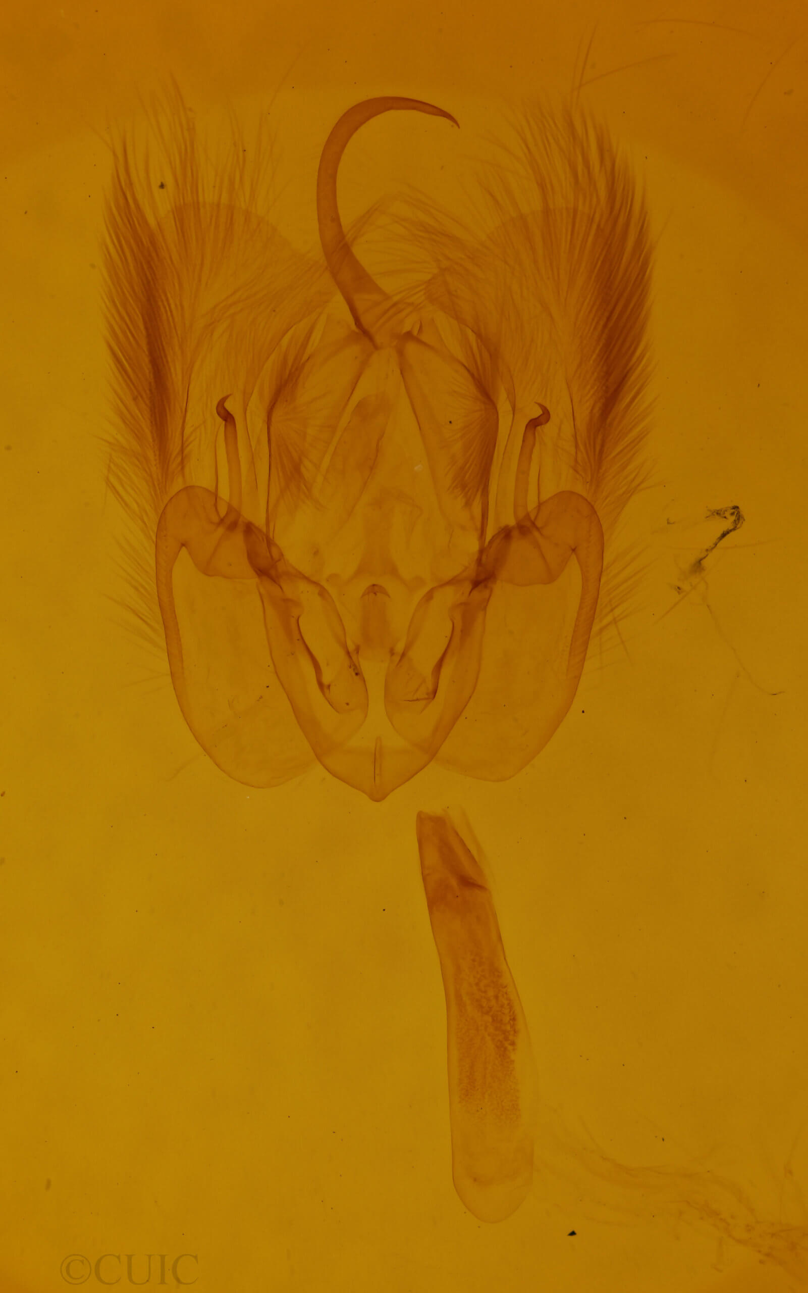 genitalia view of adult Perigea xanthioides