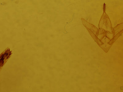 genitalia view of adult Phalaenostola hanhami