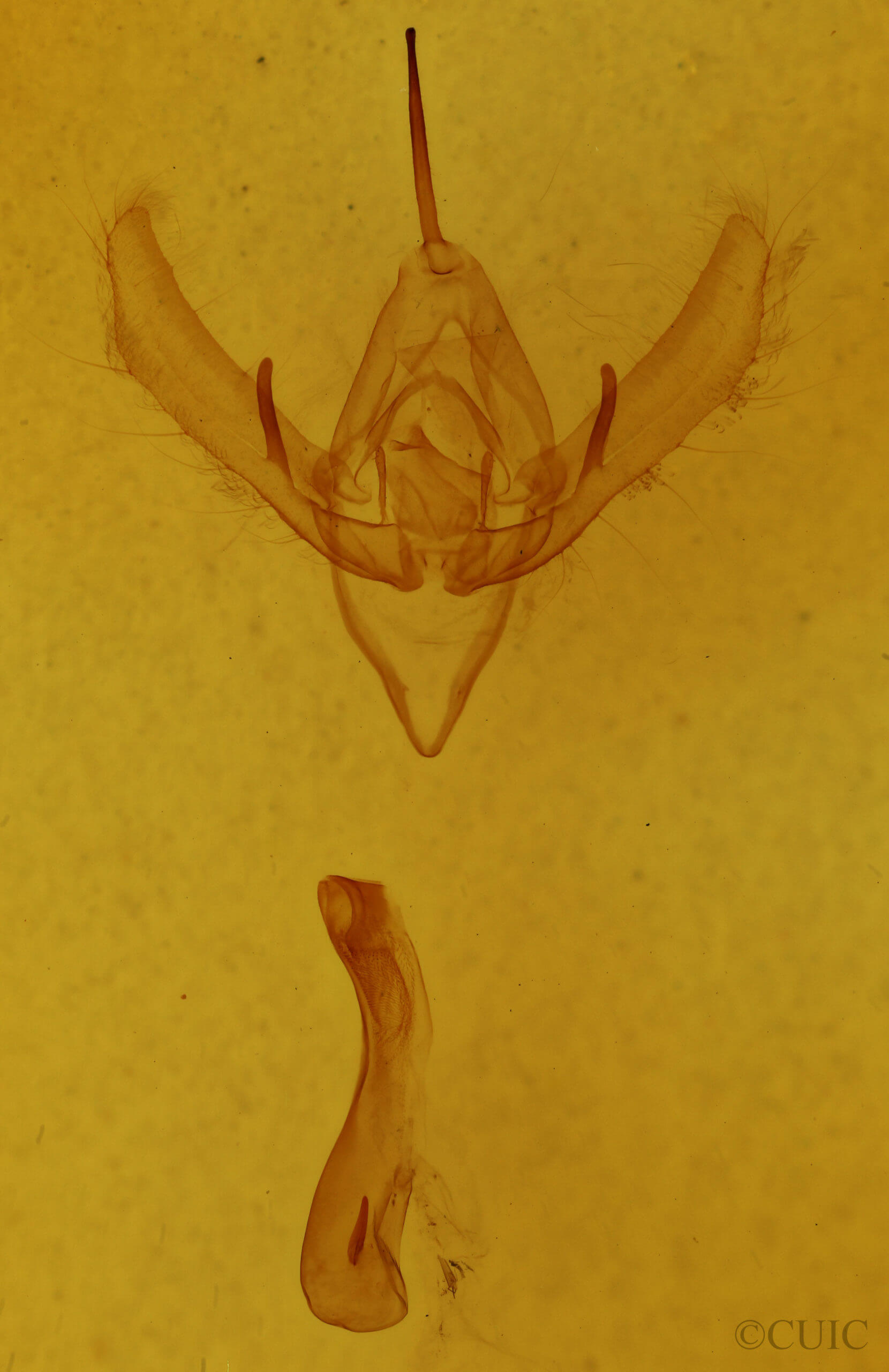 genitalia view of adult Plusia venusta