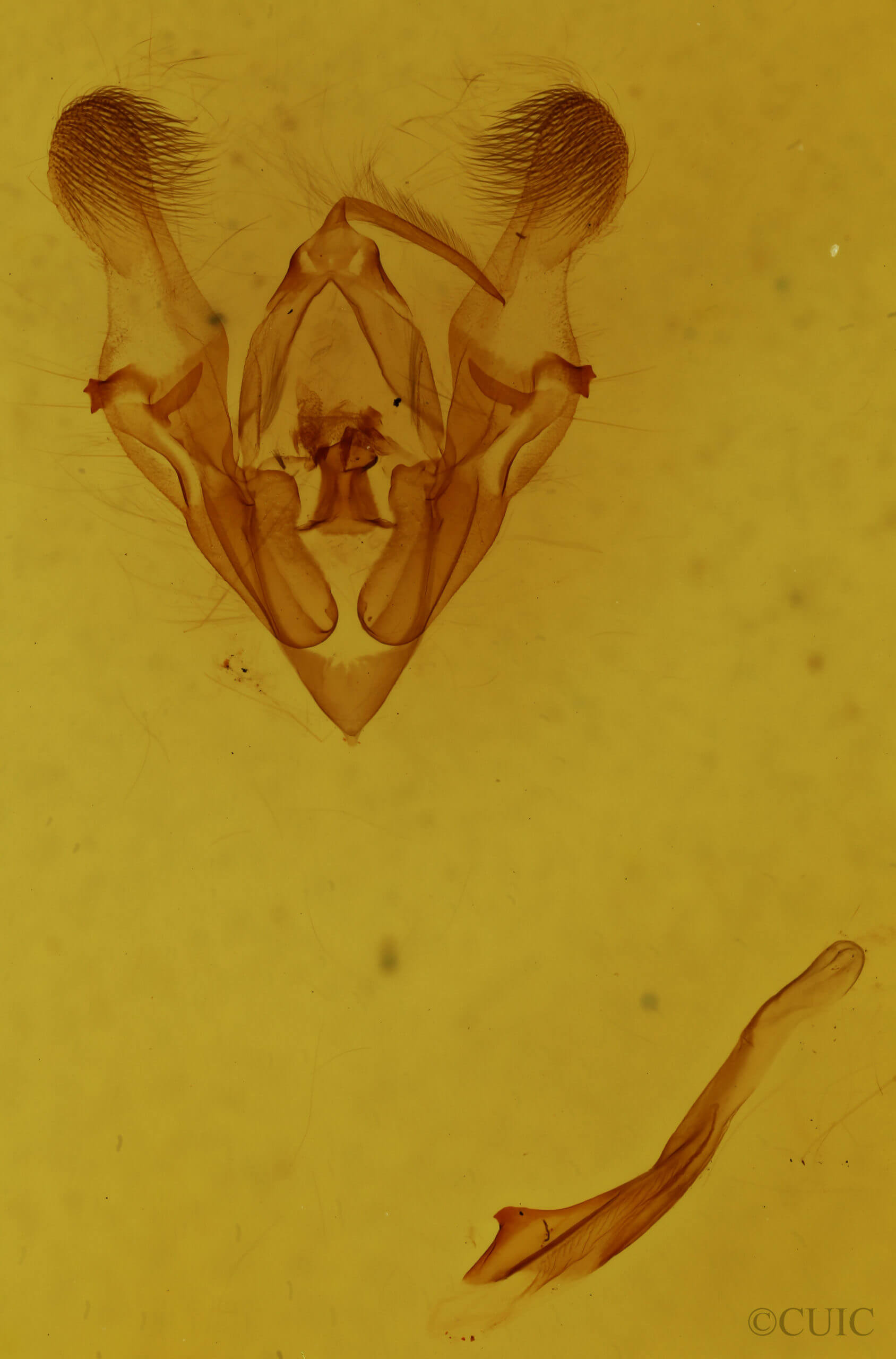 genitalia view of adult Protorthodes oviduca