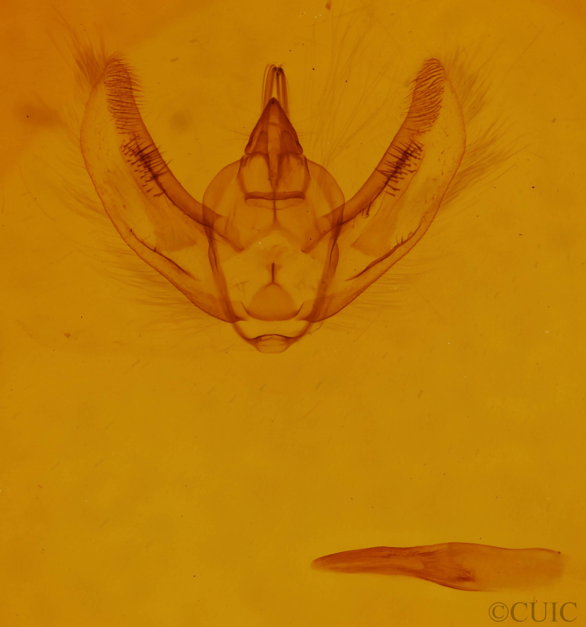 genitalia view of adult Hypomecis umbrosaria
