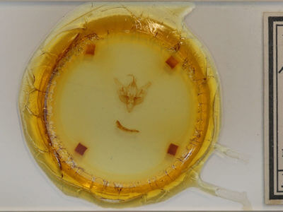 slide view of adult Pseudobryomima