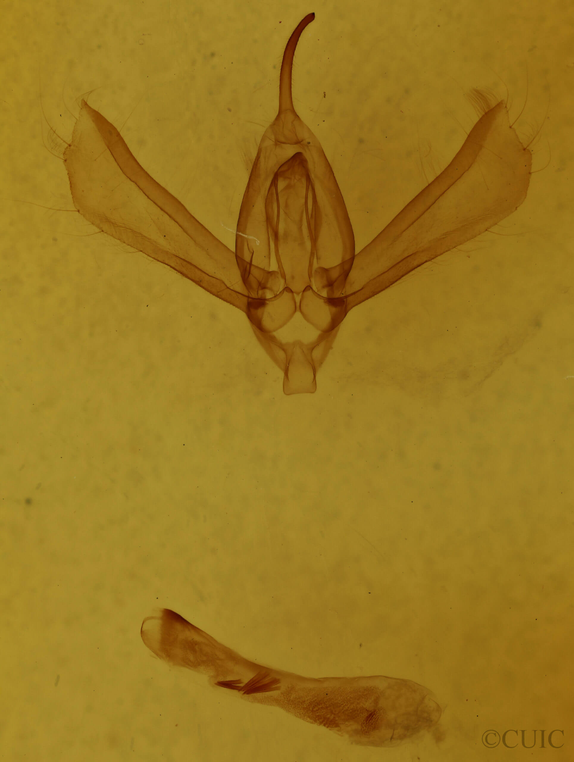 genitalia view of adult Rachiplusia ou