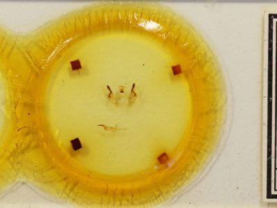 slide view of adult Rosema