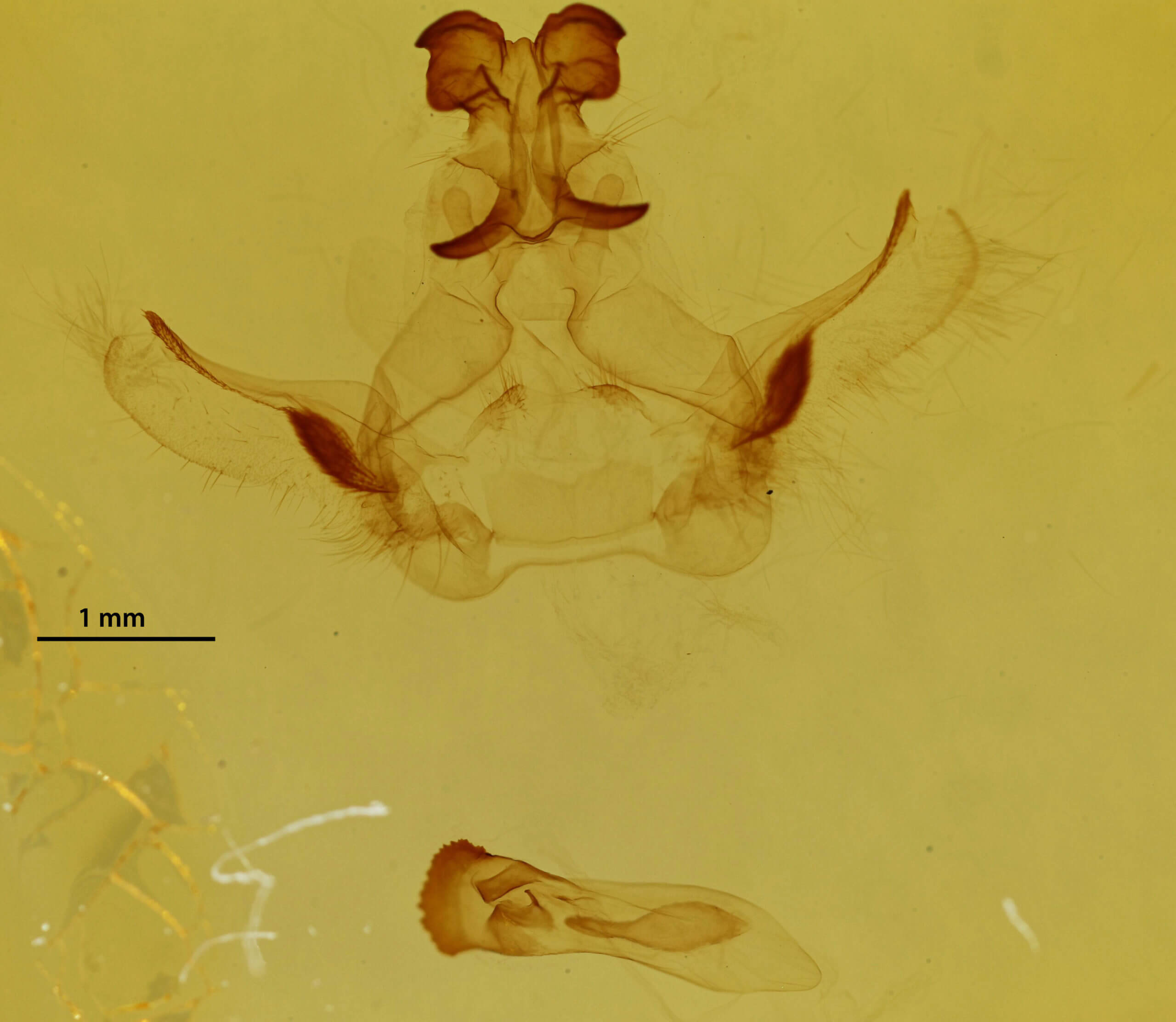 genitalia view of adult Rosema sp. XI