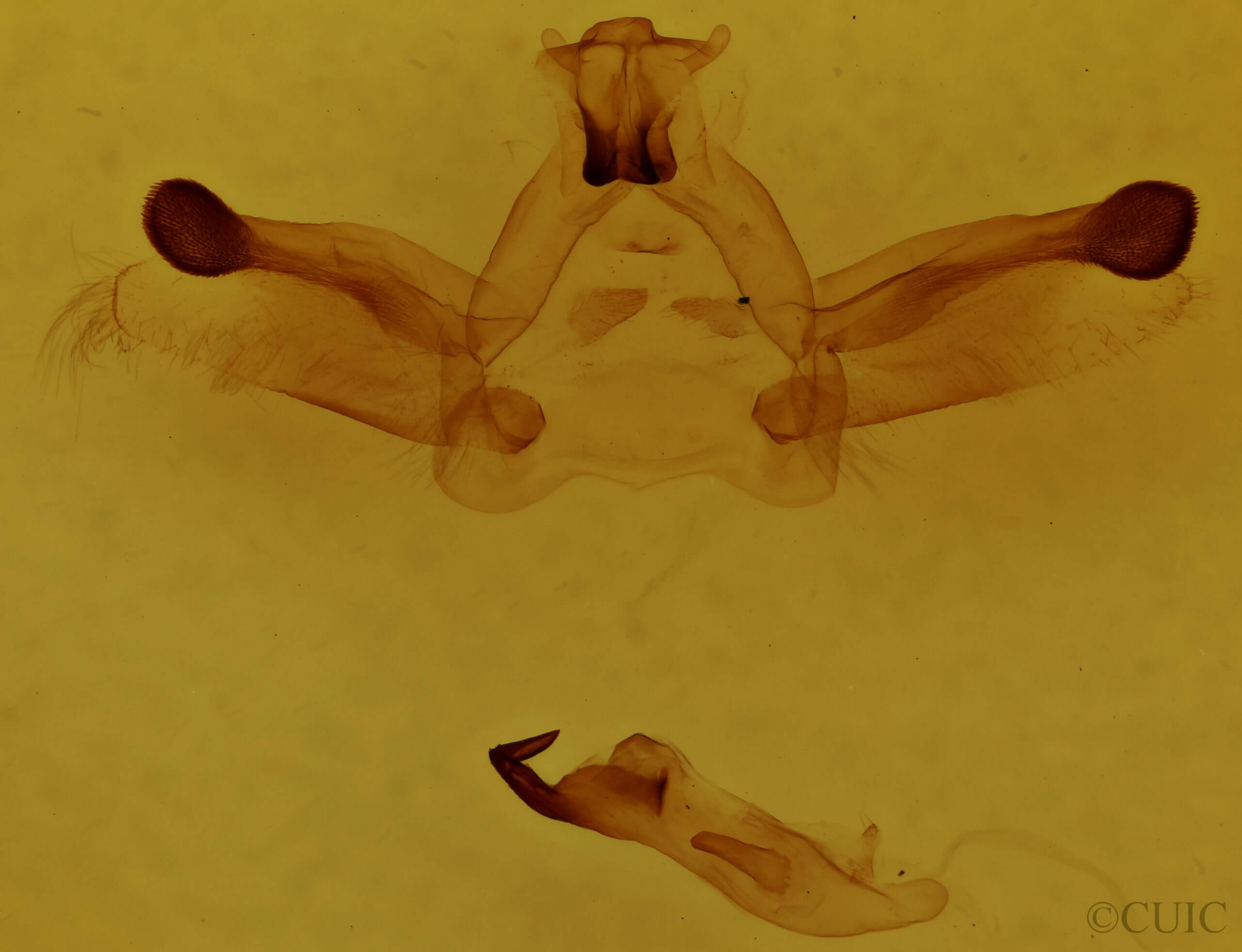 genitalia view of adult Rosema sp. XII