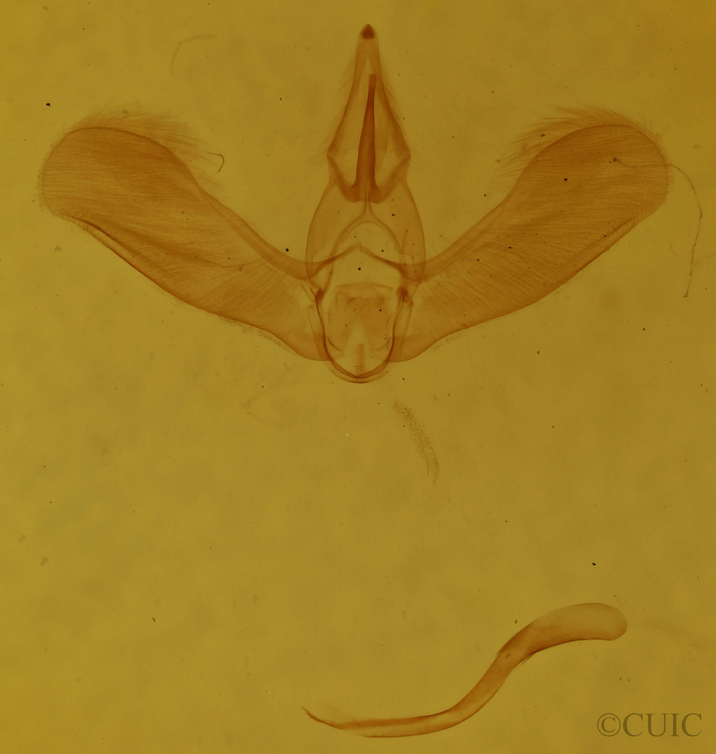 genitalia view of adult Tortricidia pallida