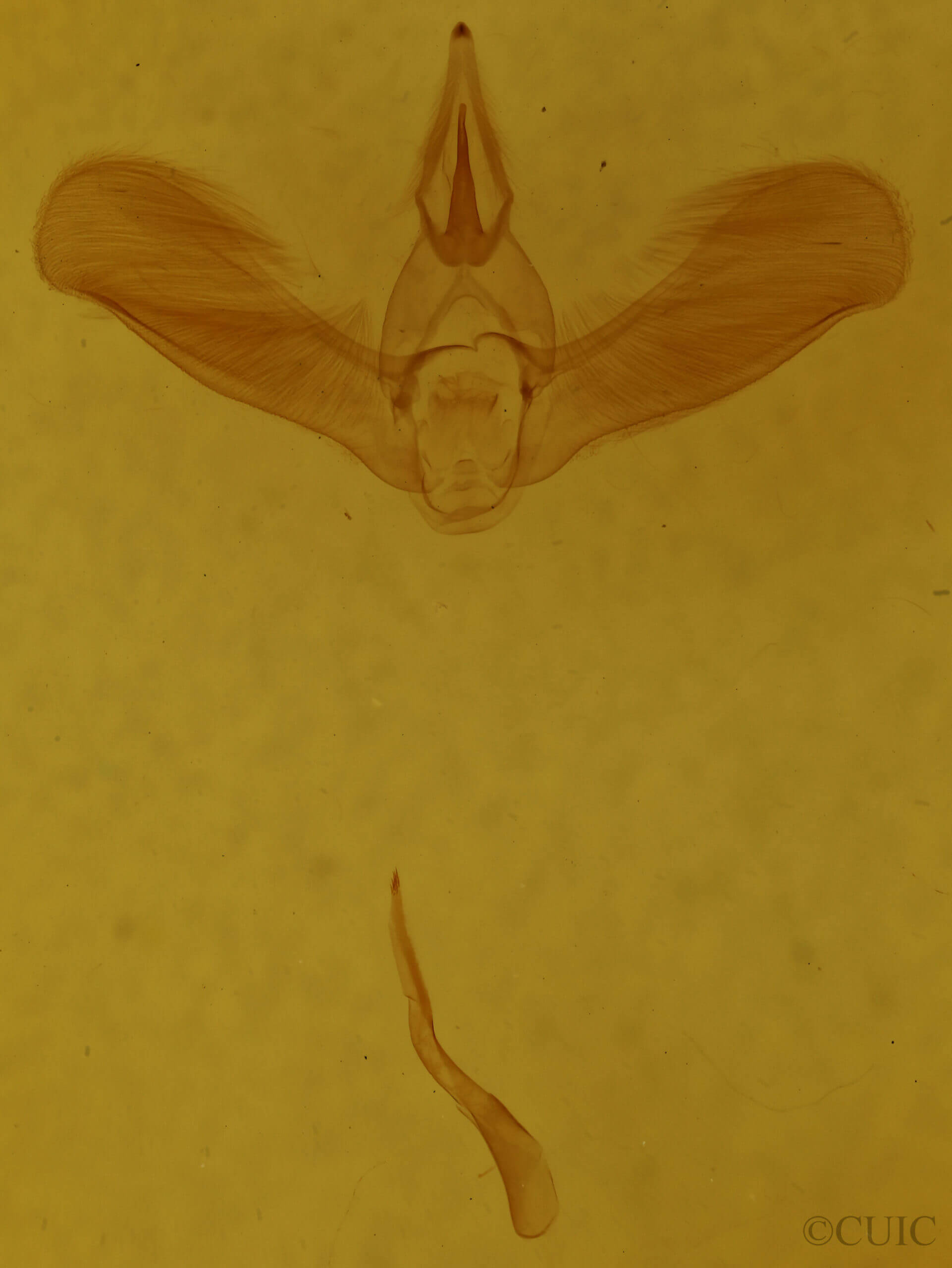 genitalia view of adult Tortricidia flexuosa