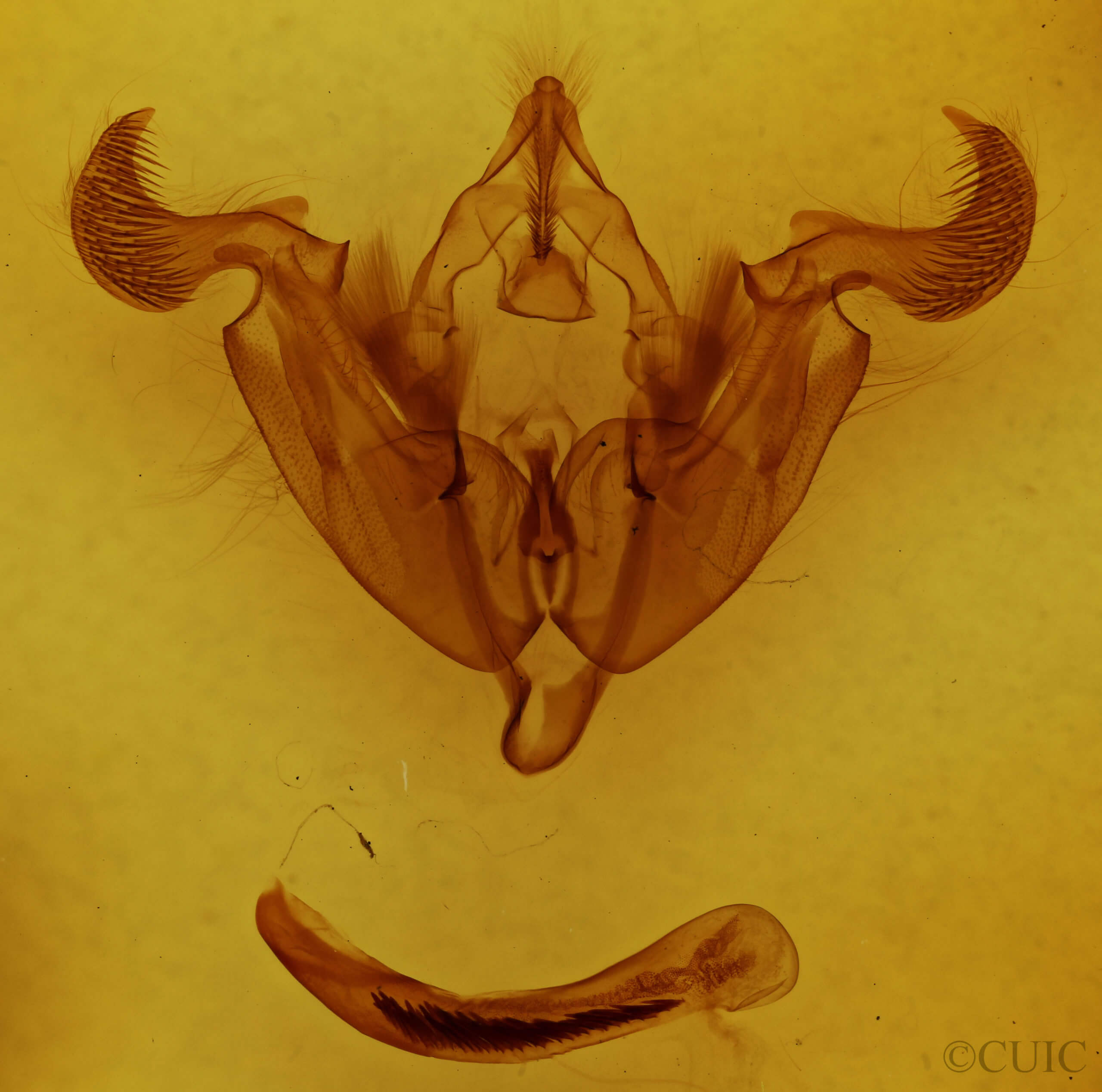genitalia view of adult Trichordestra legitima