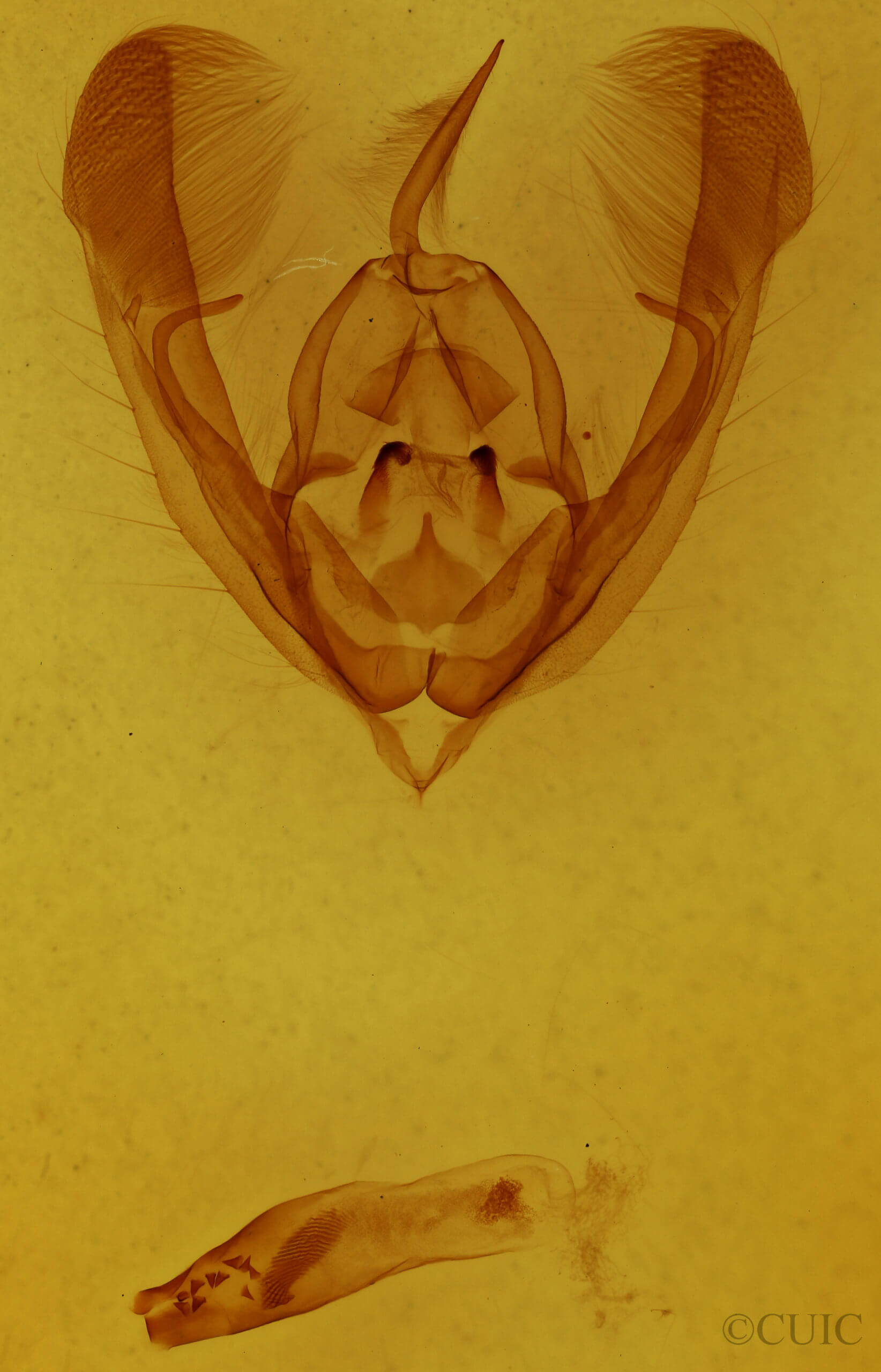 genitalia view of adult Ulolonche culea
