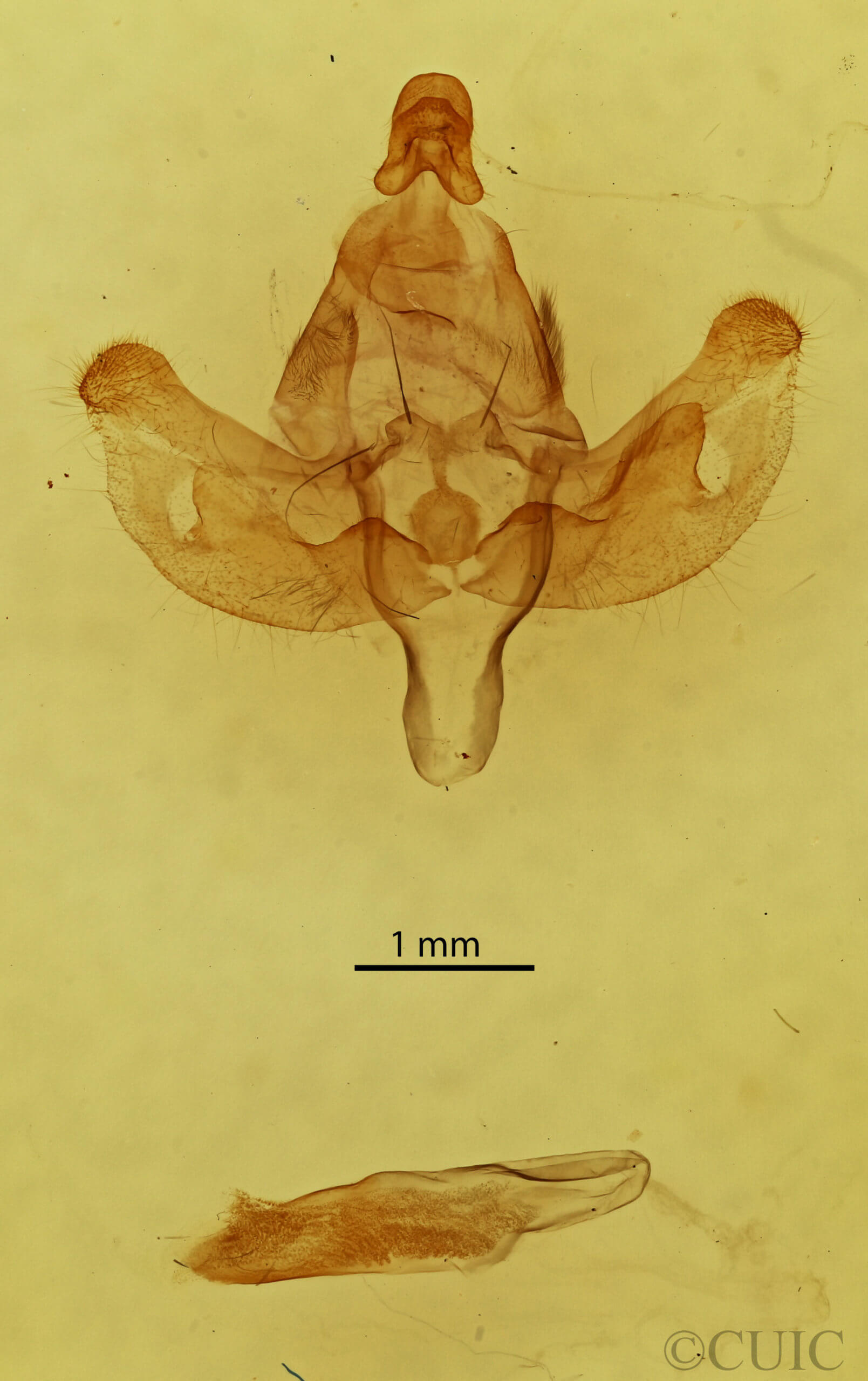 genitalia view of adult Xanthopastis  regnatrix