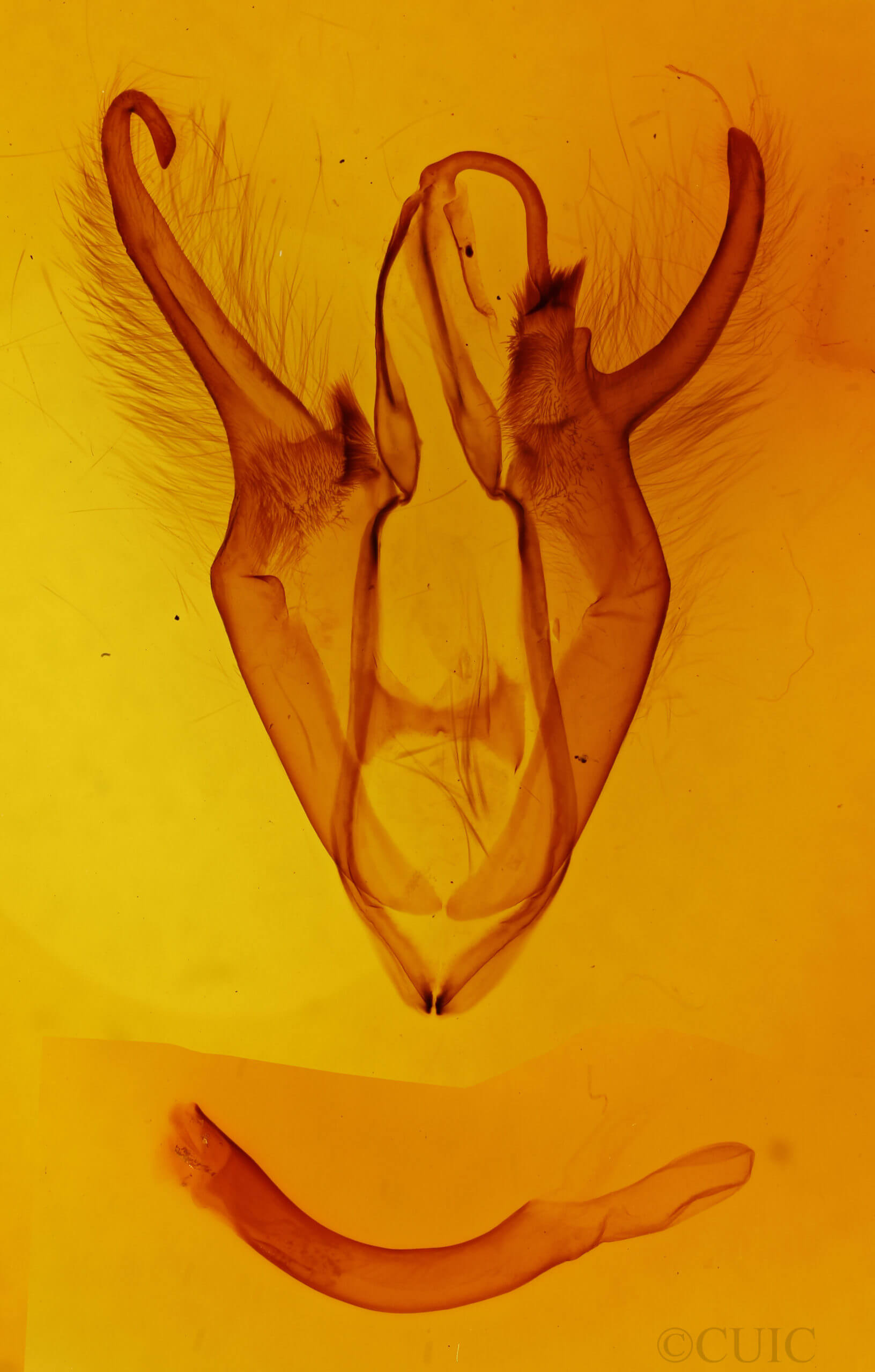 genitalia view of adult Zale buchholzi