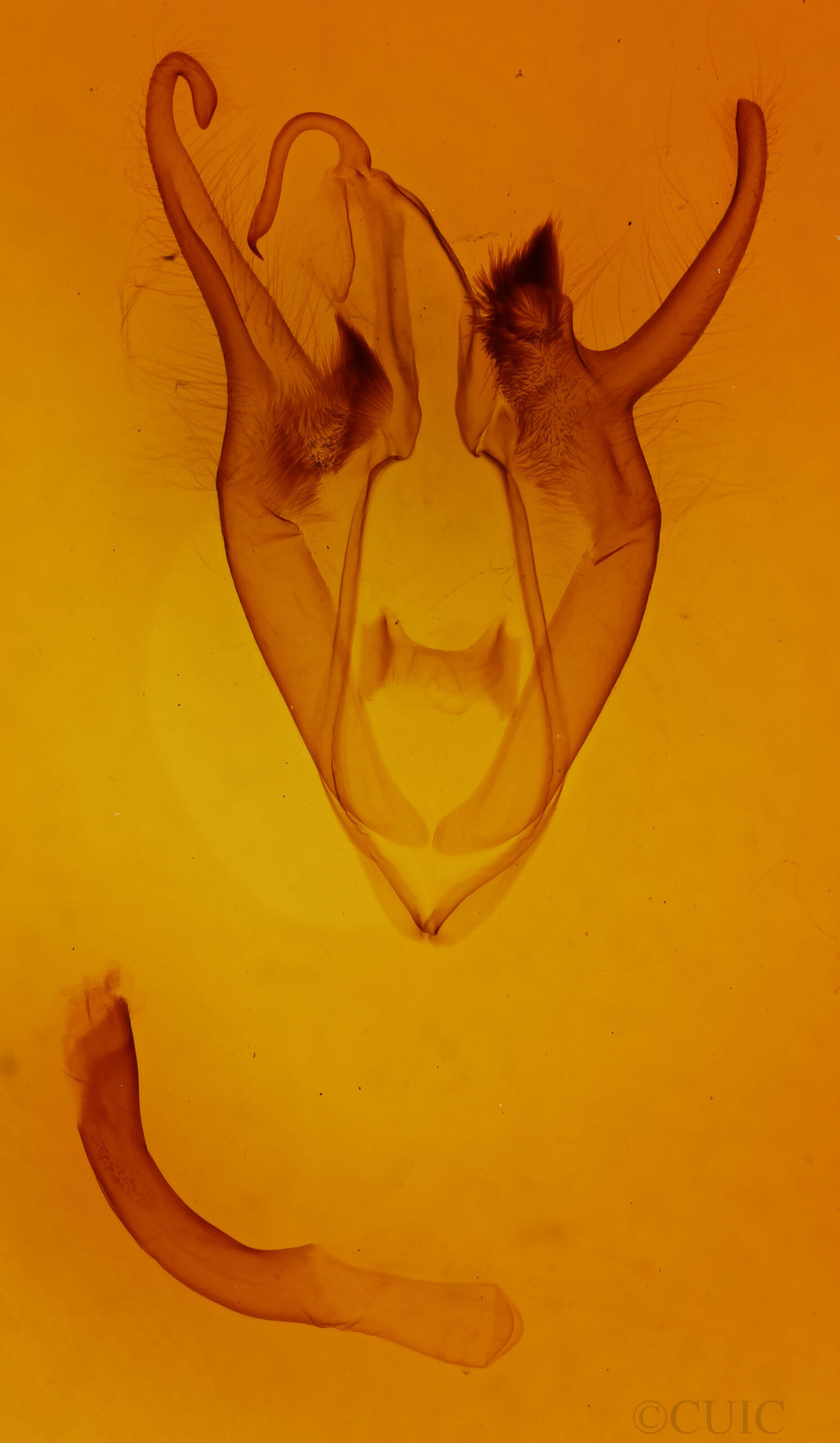 genitalia view of adult Zale buchholzi