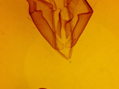 genitalia view of adult Zale phaeocapna