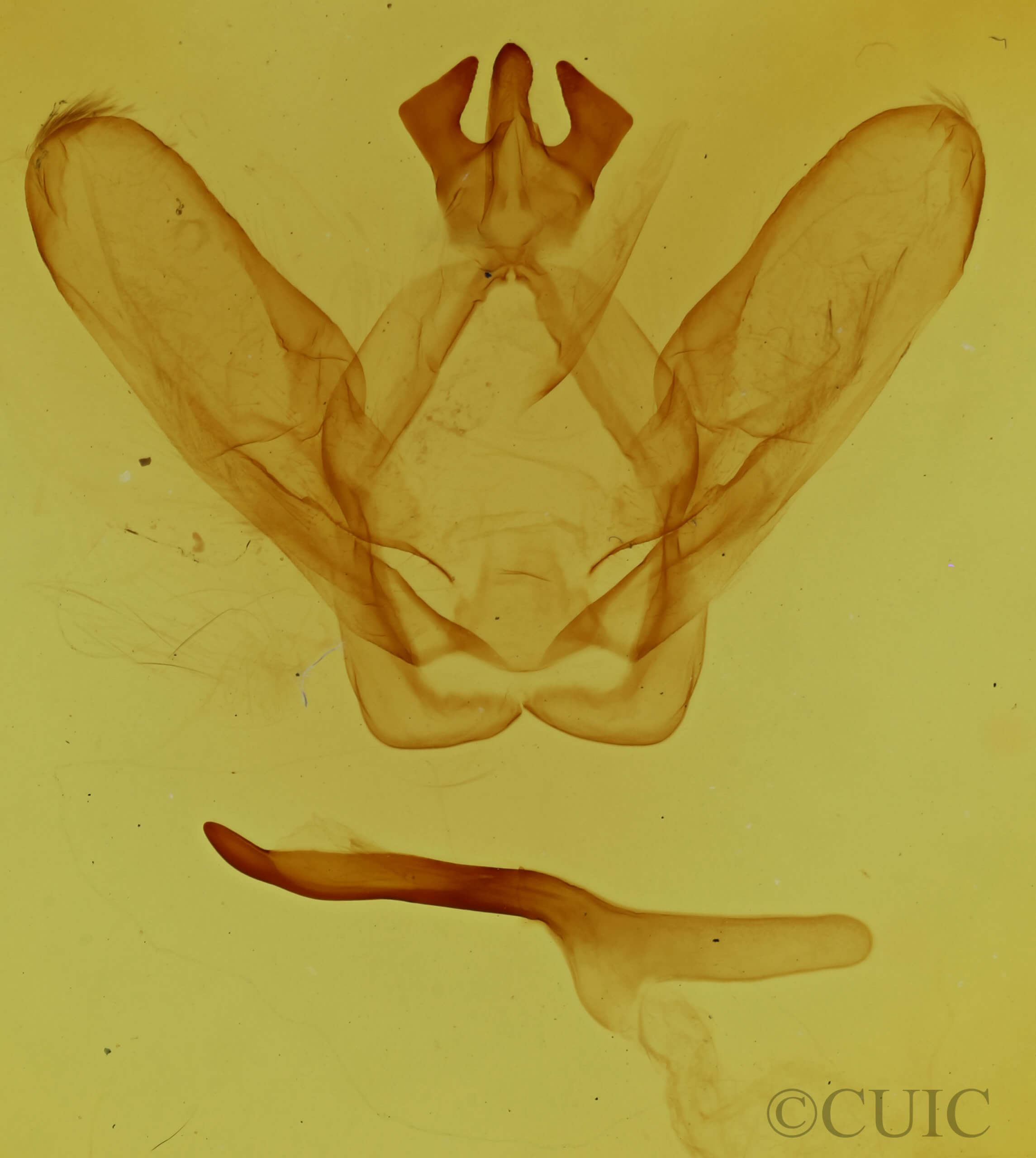 genitalia view of adult Ianassa perangulata