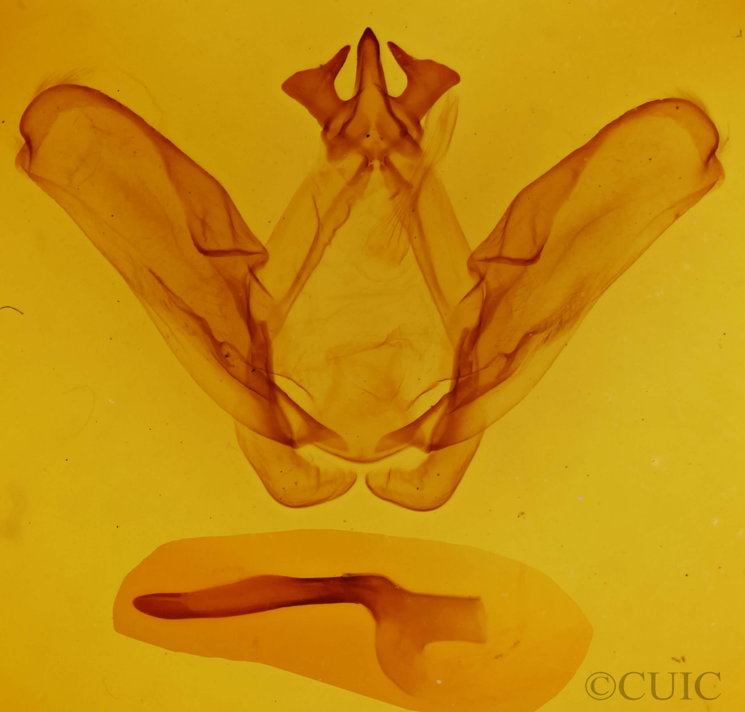 genitalia view of adult Ianassa perangulata
