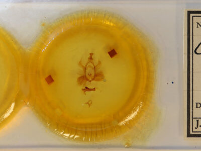 slide view of adult Chadisra