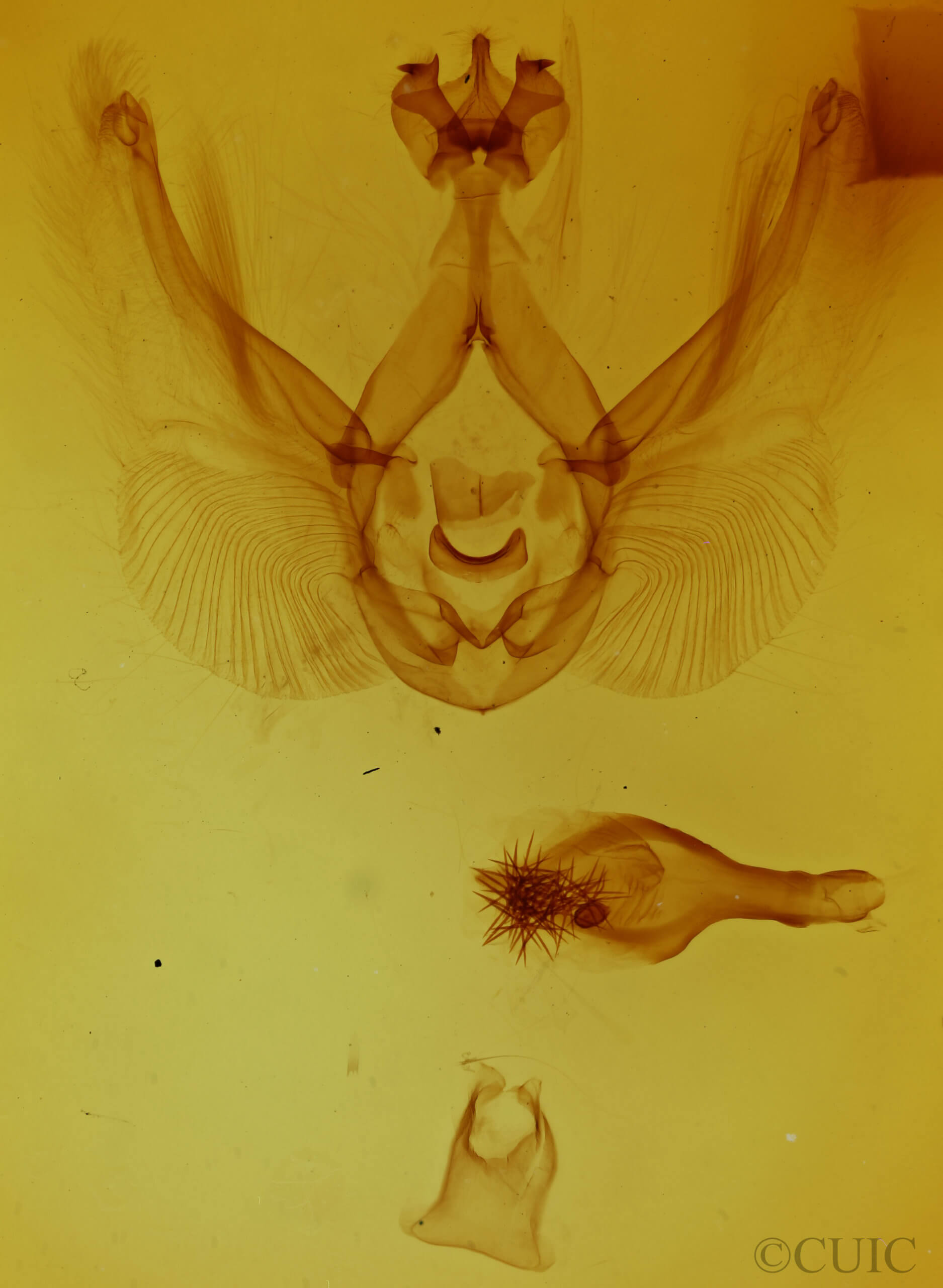 genitalia view of adult Elasmia mandela
