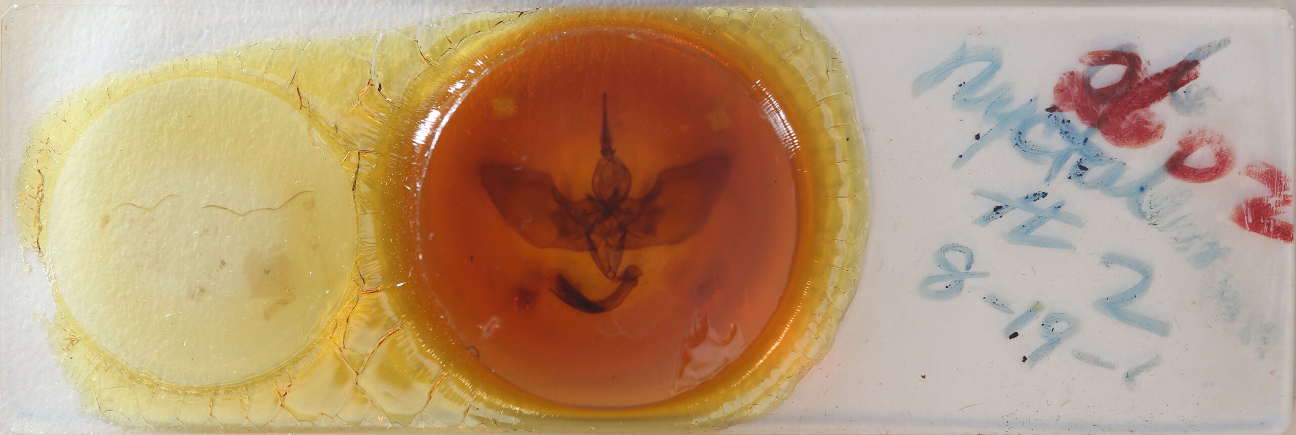 slide view of adult Lyssa