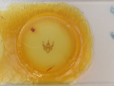 slide view of adult Pero radiosaria