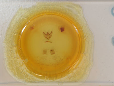 slide view of adult Cochisea