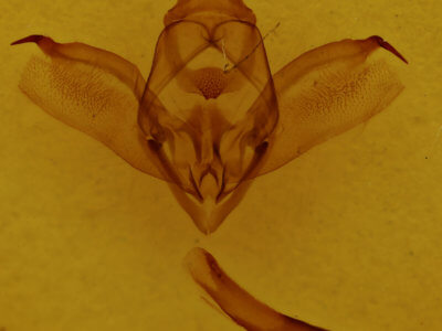 genitalia view of adult Enypia venata