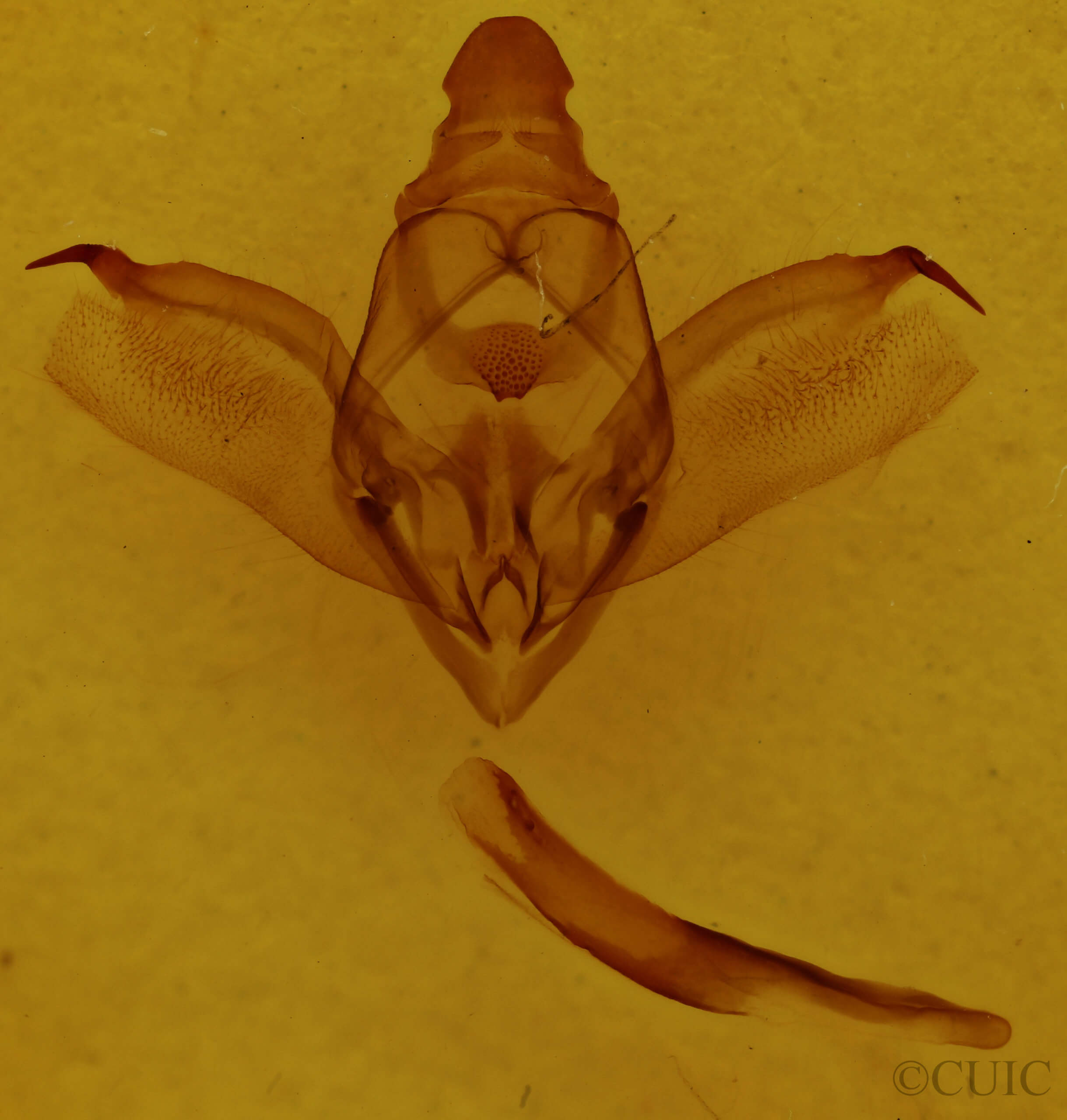 genitalia view of adult Enypia venata
