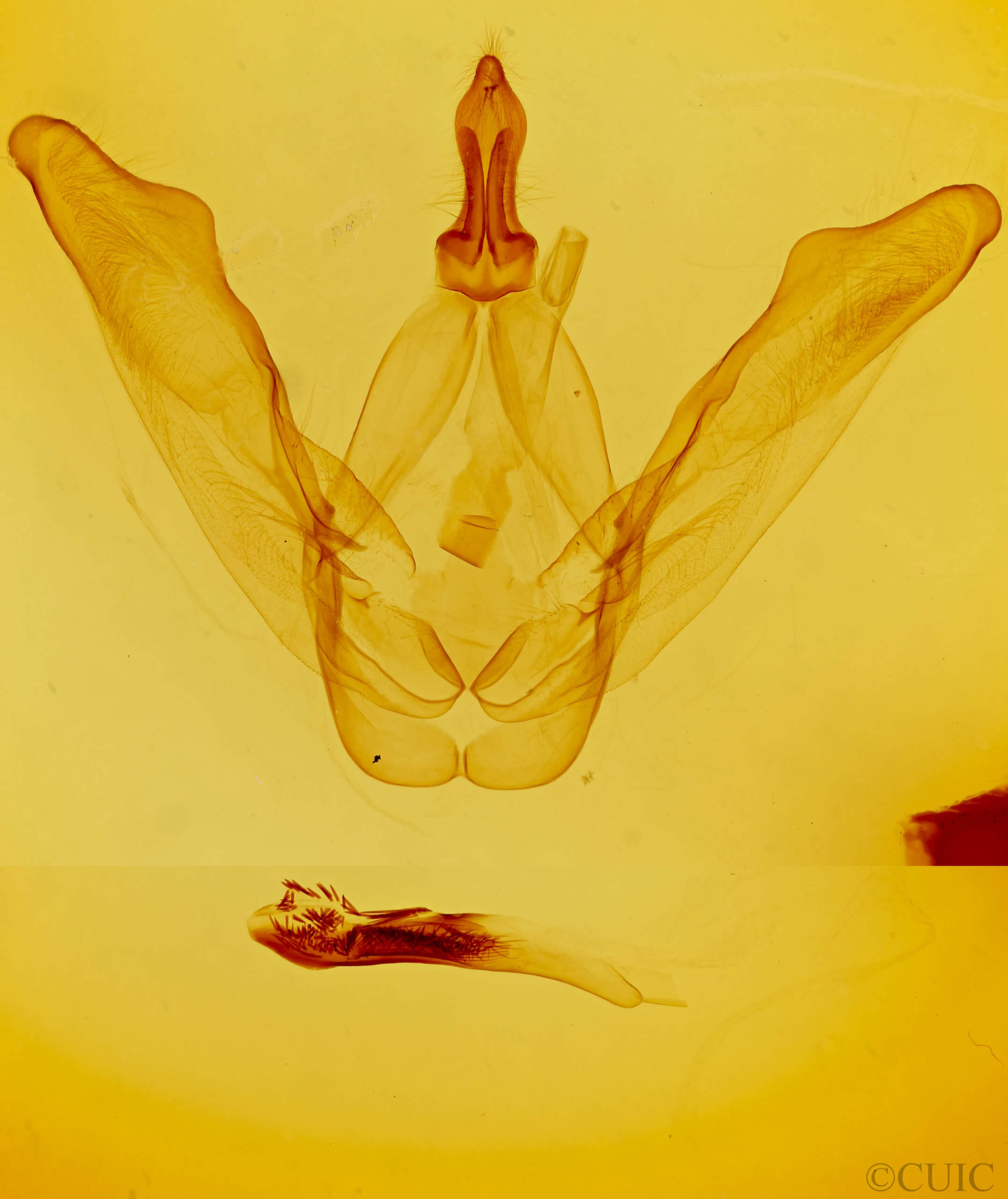 genitalia view of adult Macrurocampa zayasi