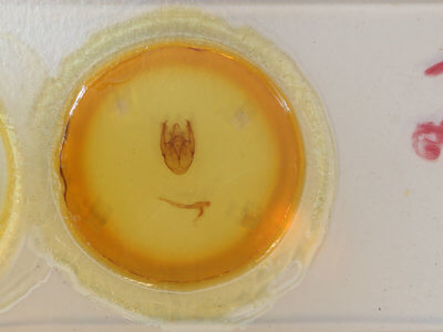 slide view of adult Xanthodes transversa