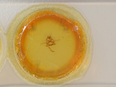 slide view of adult Kikuchiana ocularis