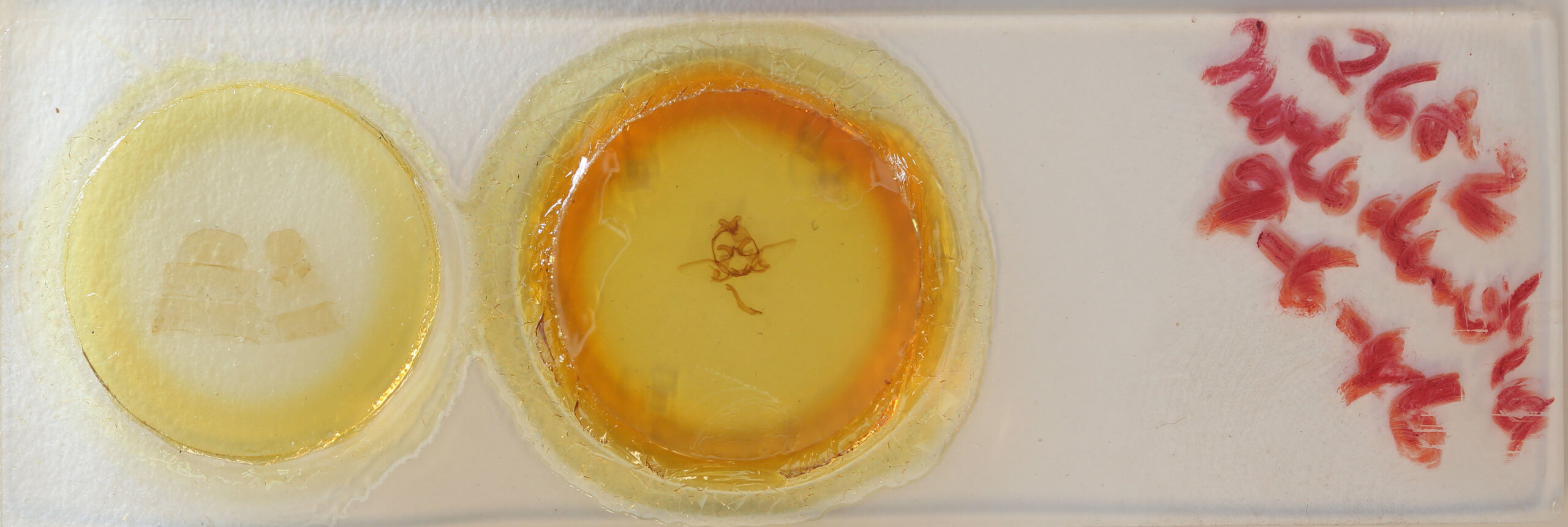 slide view of adult Kikuchiana ocularis