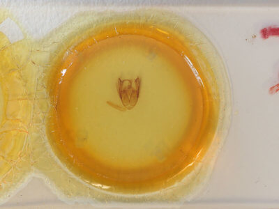 slide view of adult Xanthodes